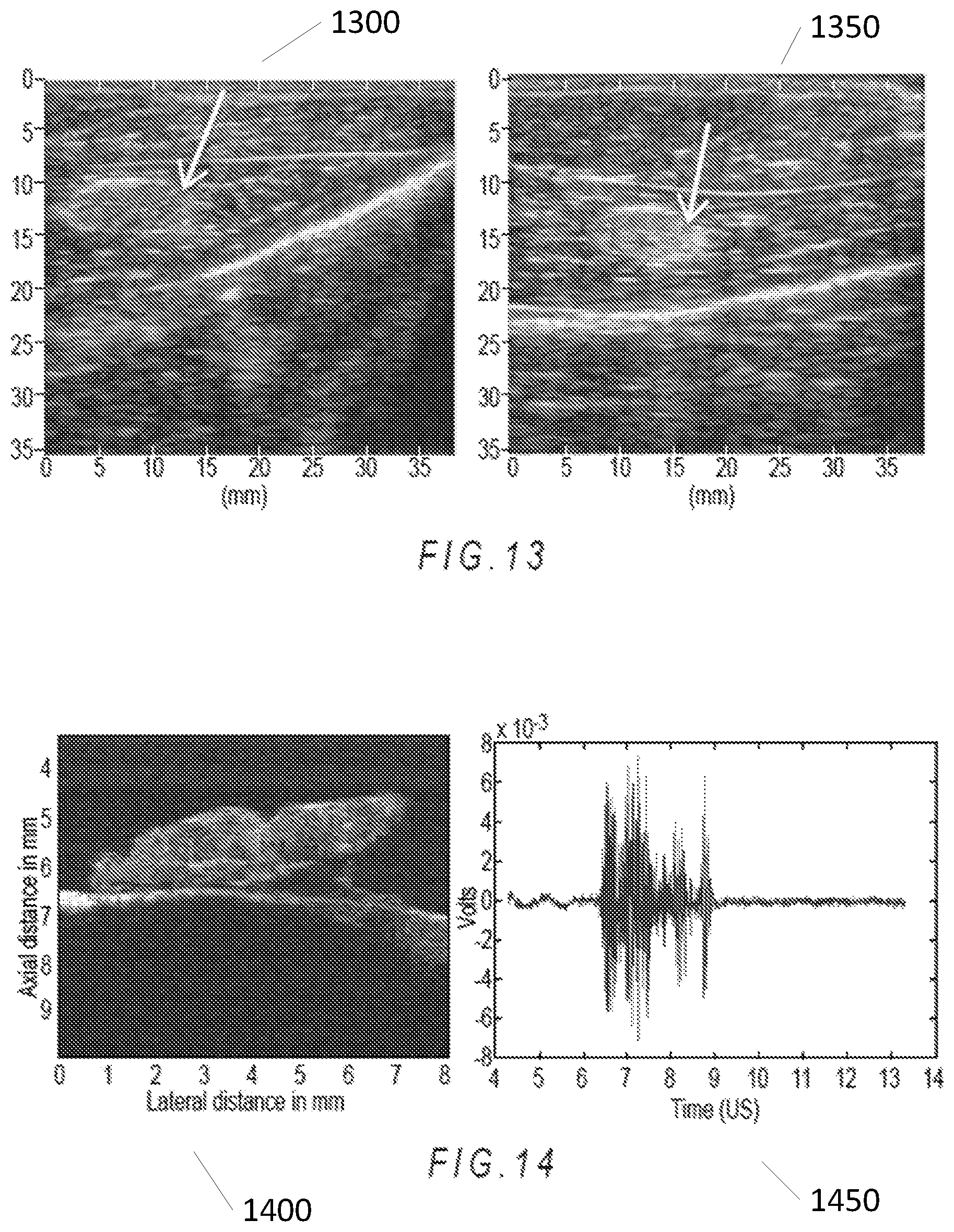 Patent US12303325 Figure 8 – Methods and systems for improved nerve detection