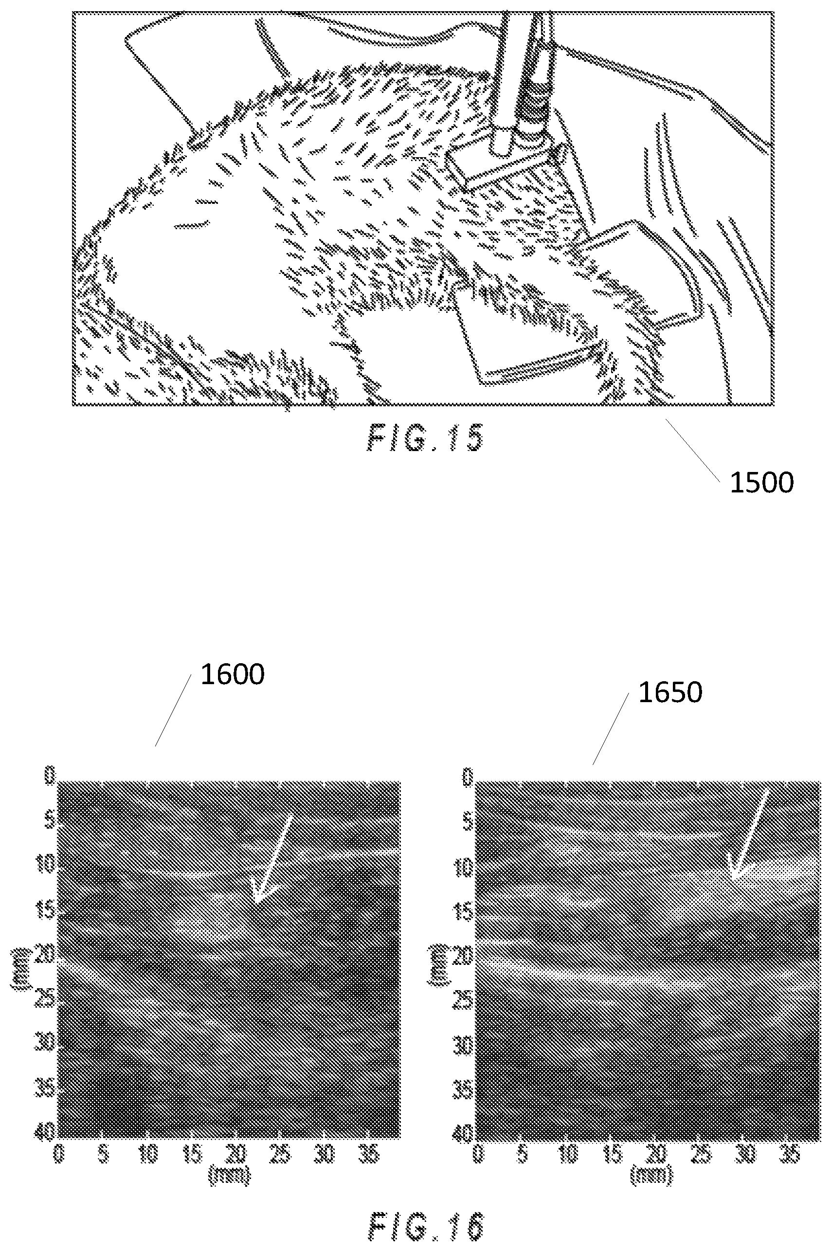 Patent US12303325 Figure 9 – Methods and systems for improved nerve detection