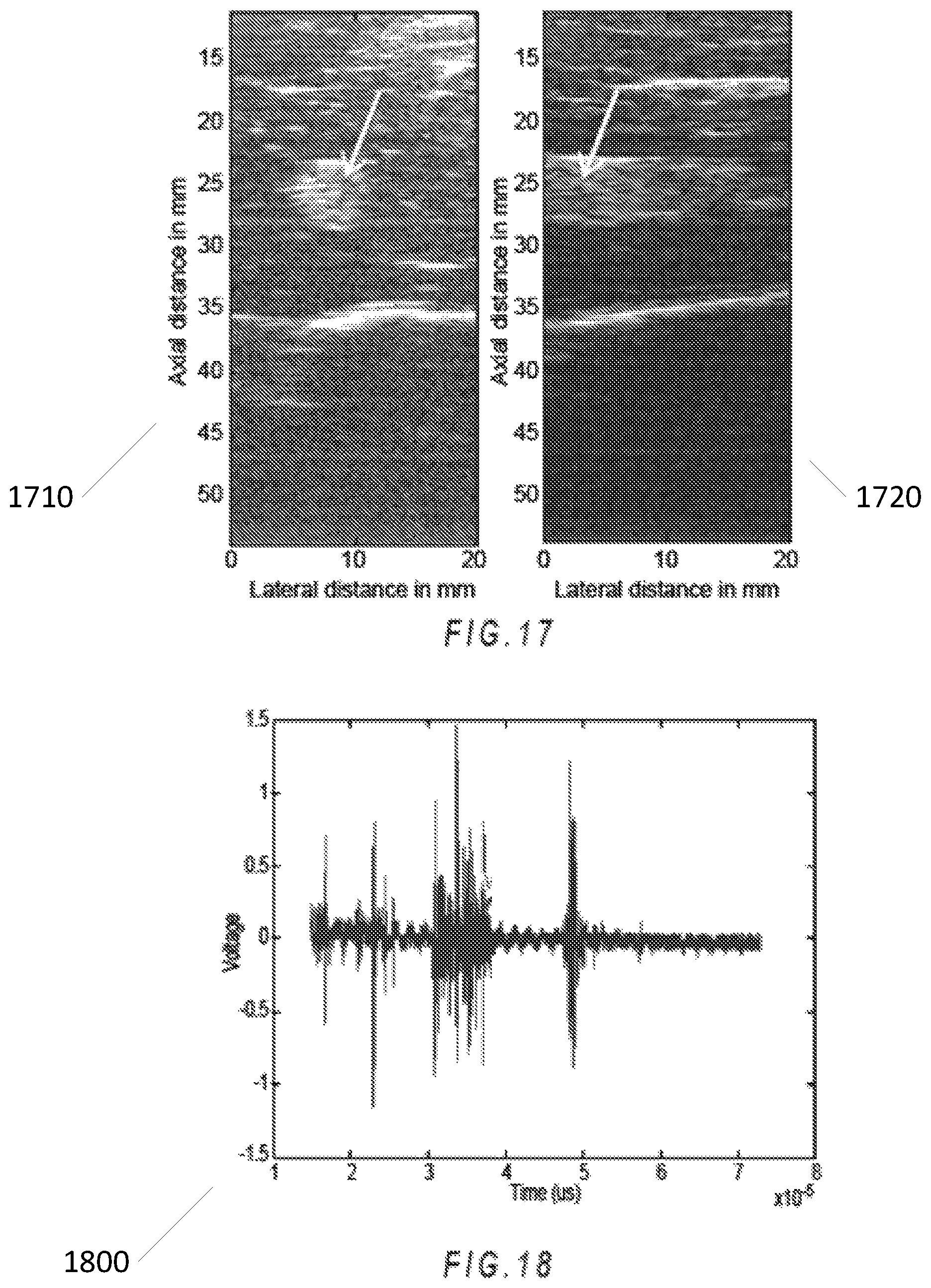 Patent US12303325 Figure 10 – Methods and systems for improved nerve detection