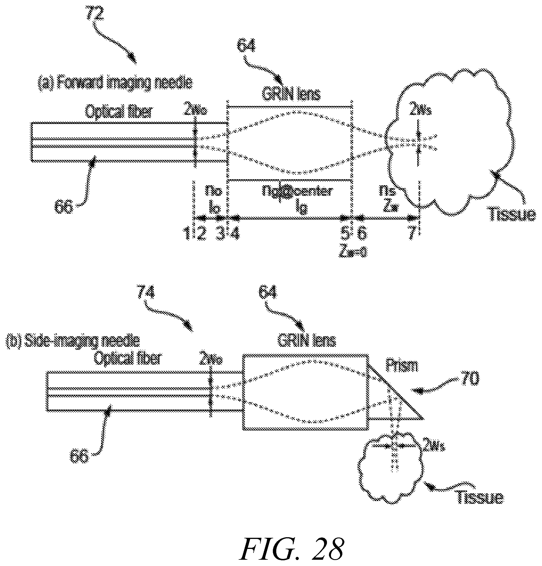Patent US12303325 Figure 16 – Methods and systems for improved nerve detection