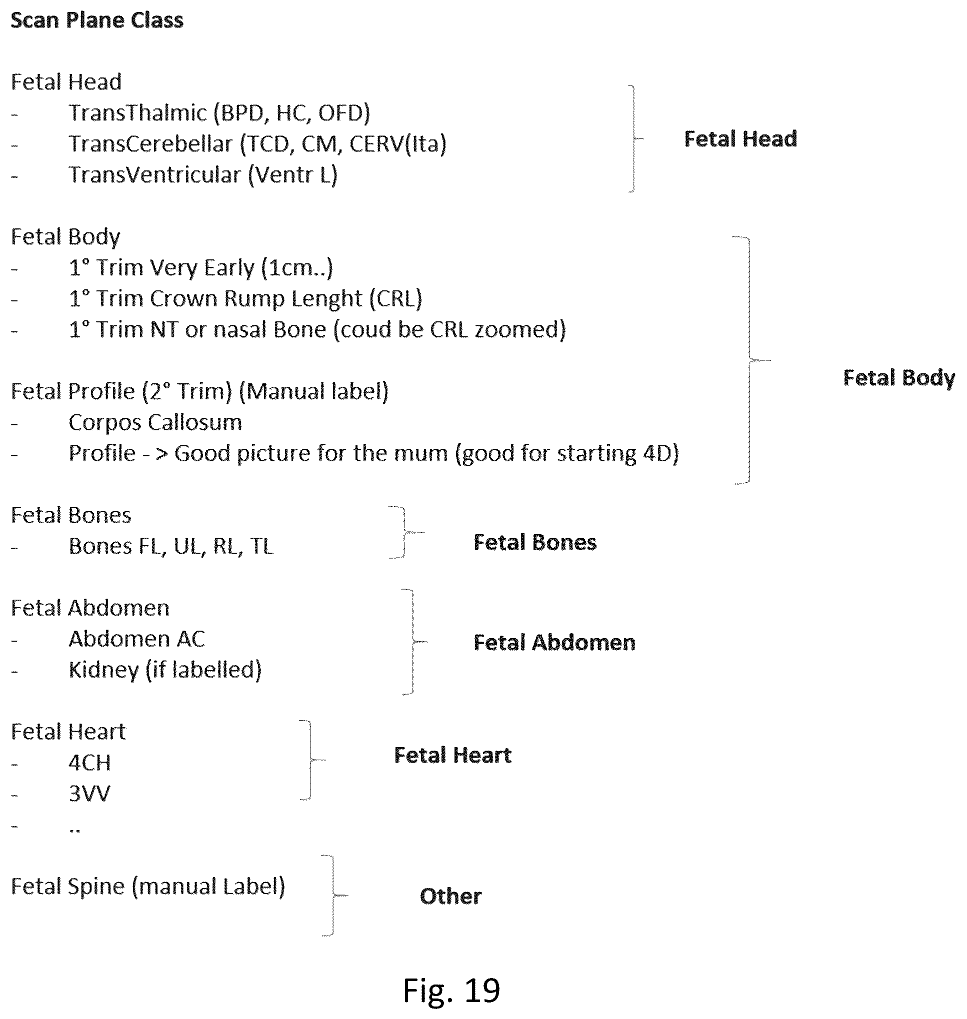 Patent US12303326 Figure 16 – Method of determining scan planes in the acquisition of ultrasound images and ultrasound system for the implementation of the method