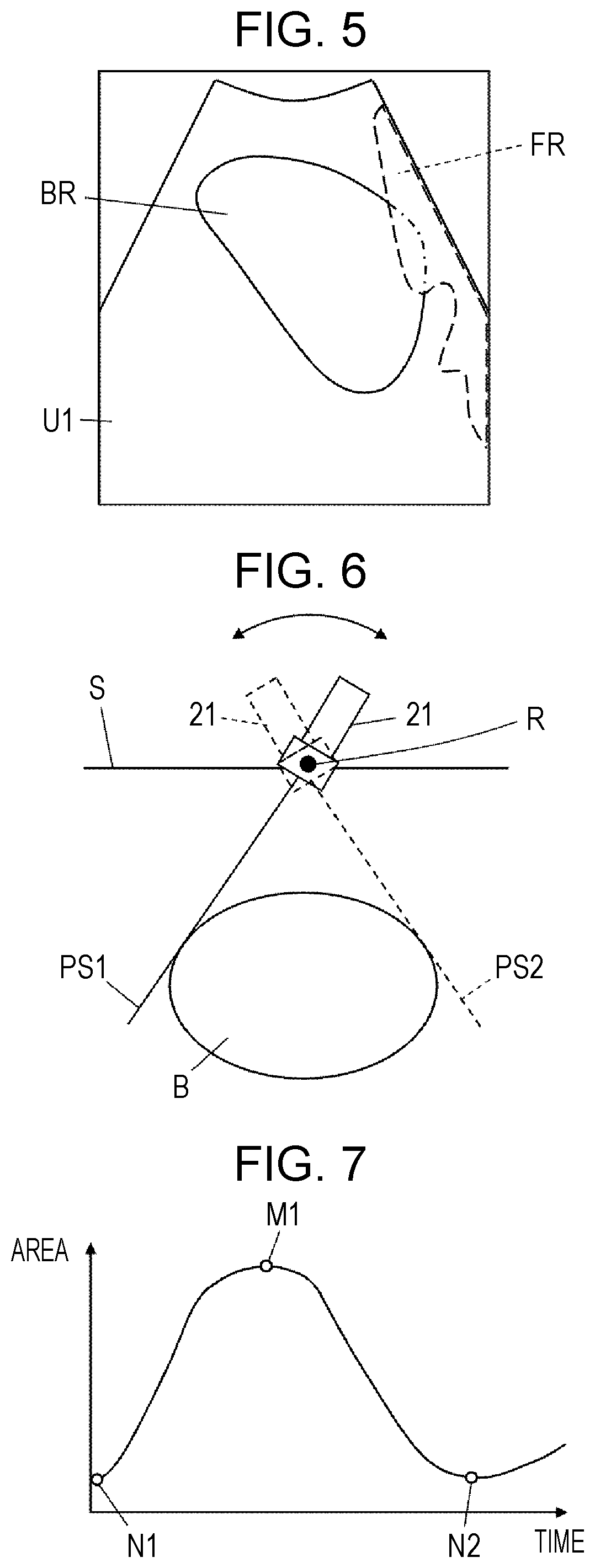 Patent US12303330 Figure 3 – Ultrasound diagnostic apparatus, method for controlling ultrasound diagnostic apparatus, and processor for ultrasound diagnostic apparatus