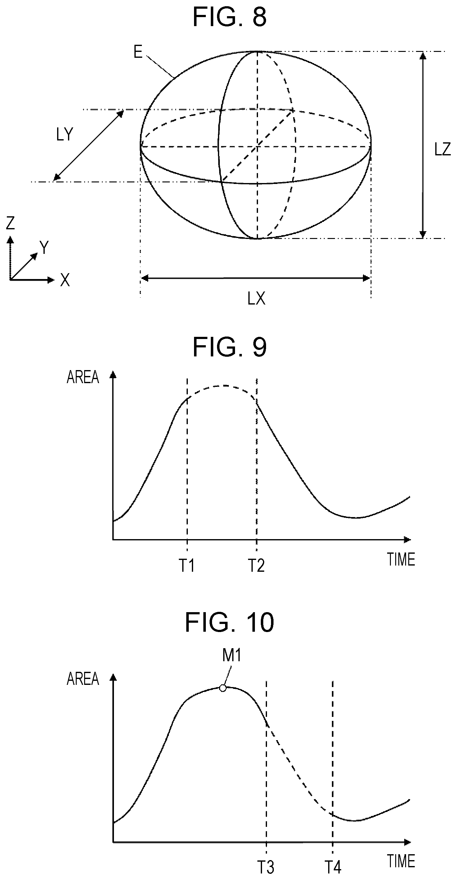 Patent US12303330 Figure 4 – Ultrasound diagnostic apparatus, method for controlling ultrasound diagnostic apparatus, and processor for ultrasound diagnostic apparatus