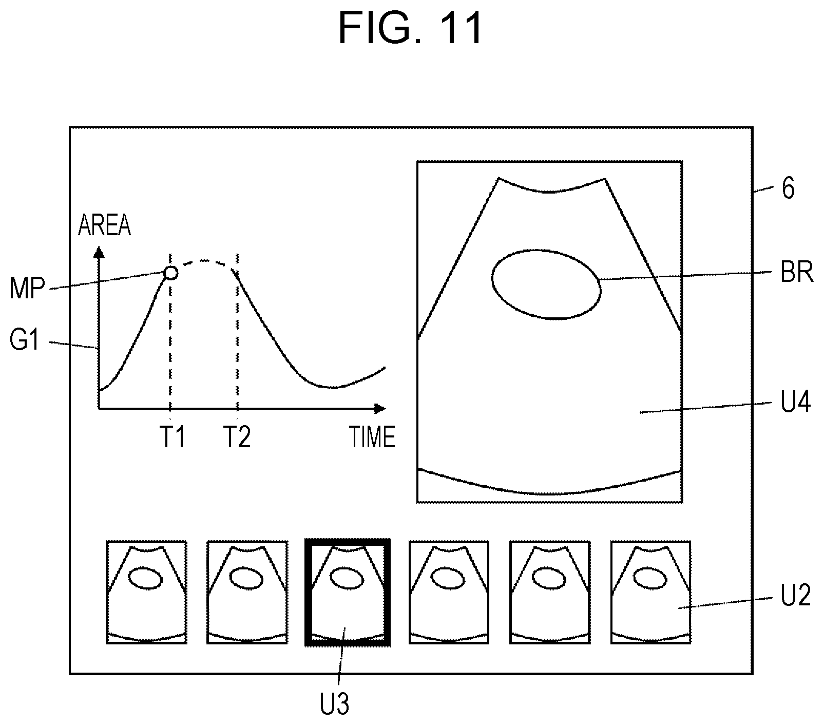 Patent US12303330 Figure 5 – Ultrasound diagnostic apparatus, method for controlling ultrasound diagnostic apparatus, and processor for ultrasound diagnostic apparatus