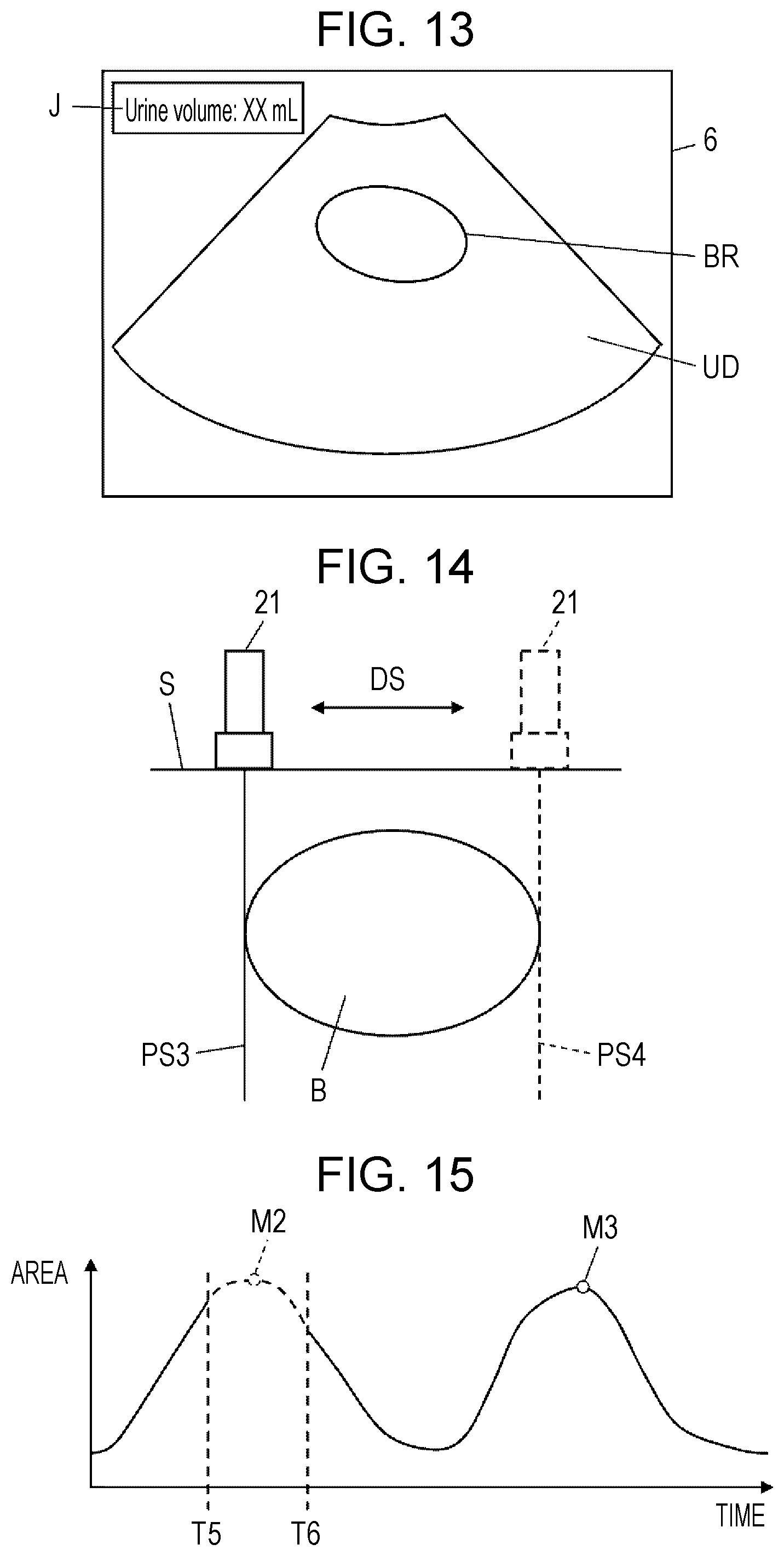 Patent US12303330 Figure 7 – Ultrasound diagnostic apparatus, method for controlling ultrasound diagnostic apparatus, and processor for ultrasound diagnostic apparatus
