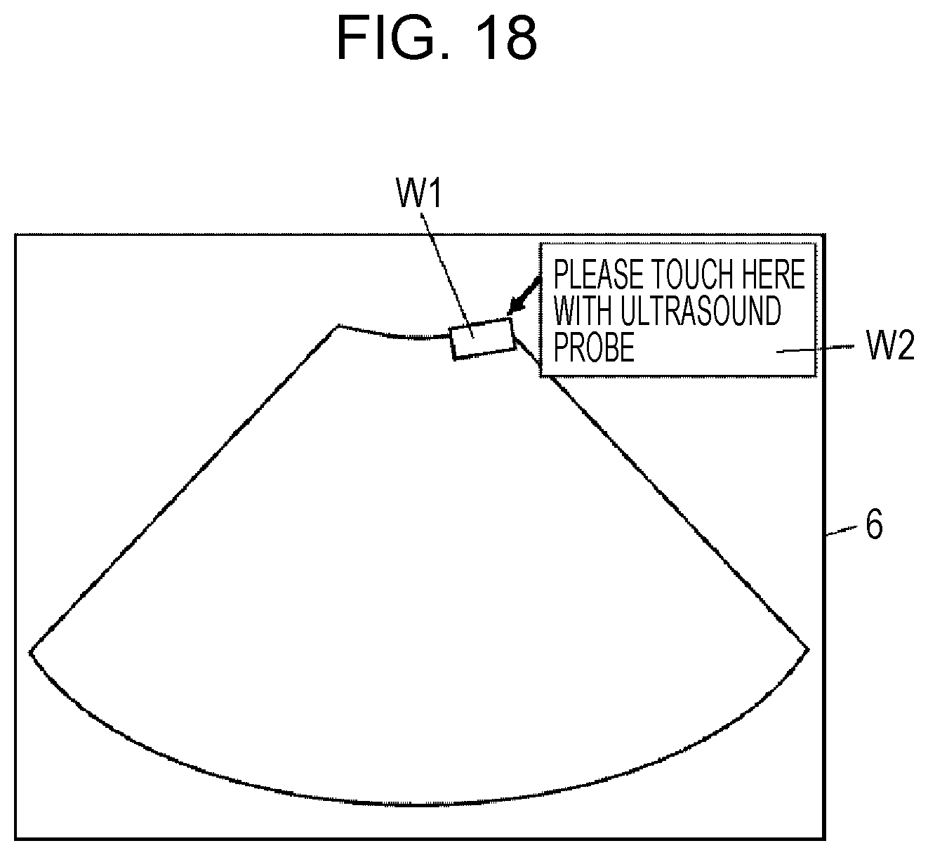 Patent US12303330 Figure 9 – Ultrasound diagnostic apparatus, method for controlling ultrasound diagnostic apparatus, and processor for ultrasound diagnostic apparatus