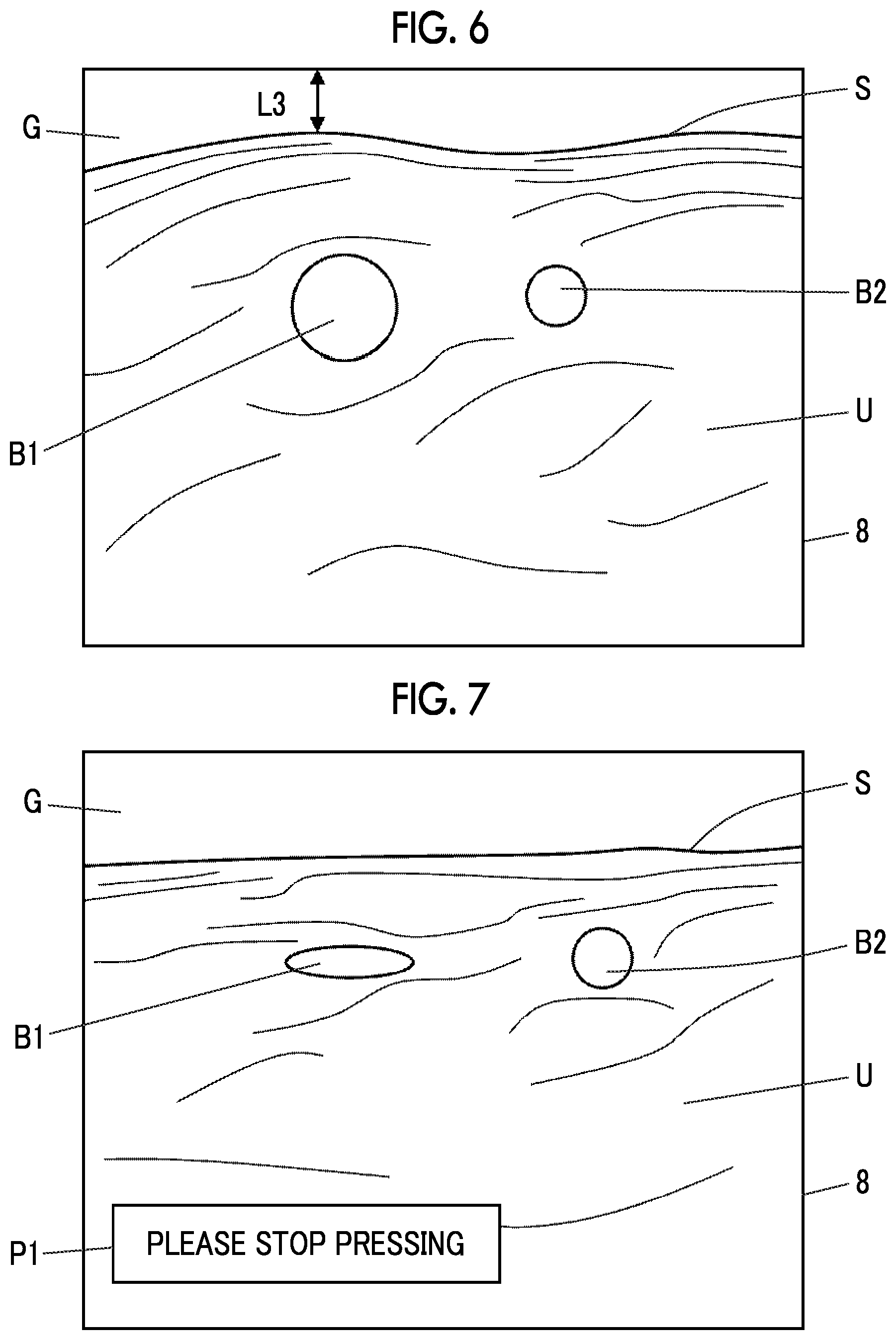 Patent US12303331 Figure 4 – Ultrasound diagnostic apparatus and control method of ultrasound diagnostic apparatus