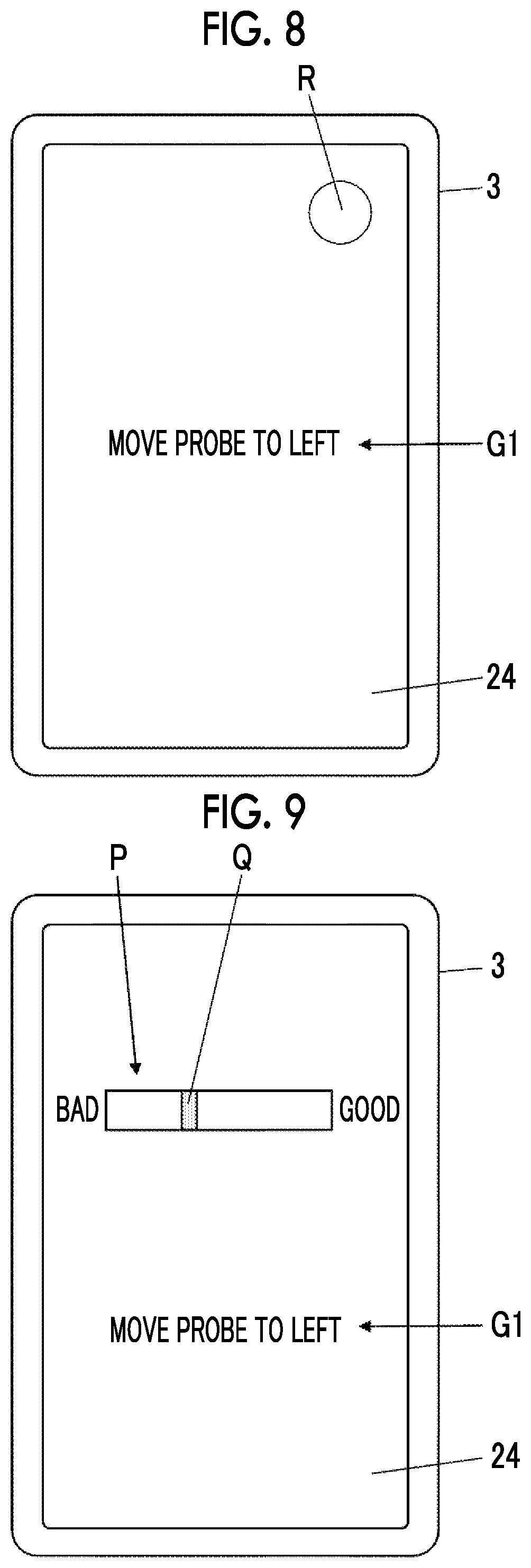Patent US12303332 Figure 5 – Ultrasound diagnostic system and control method of ultrasound diagnostic system