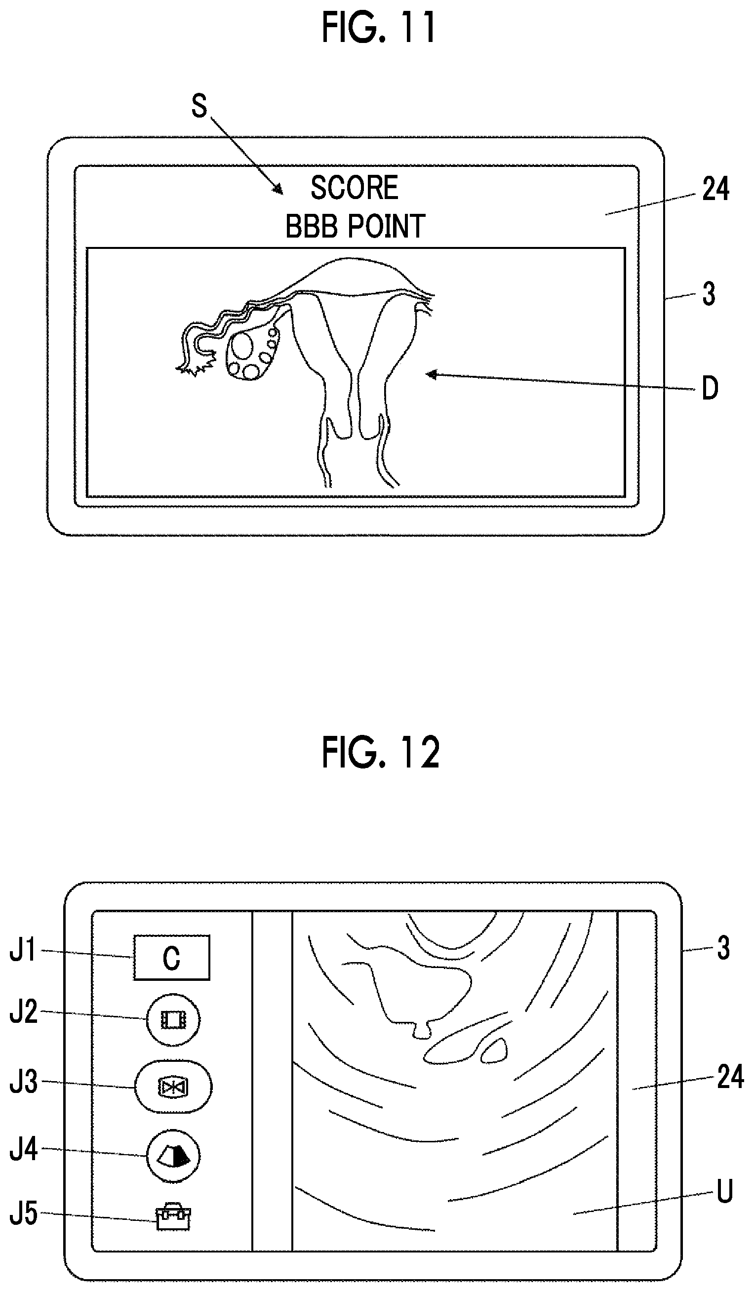 Patent US12303332 Figure 7 – Ultrasound diagnostic system and control method of ultrasound diagnostic system