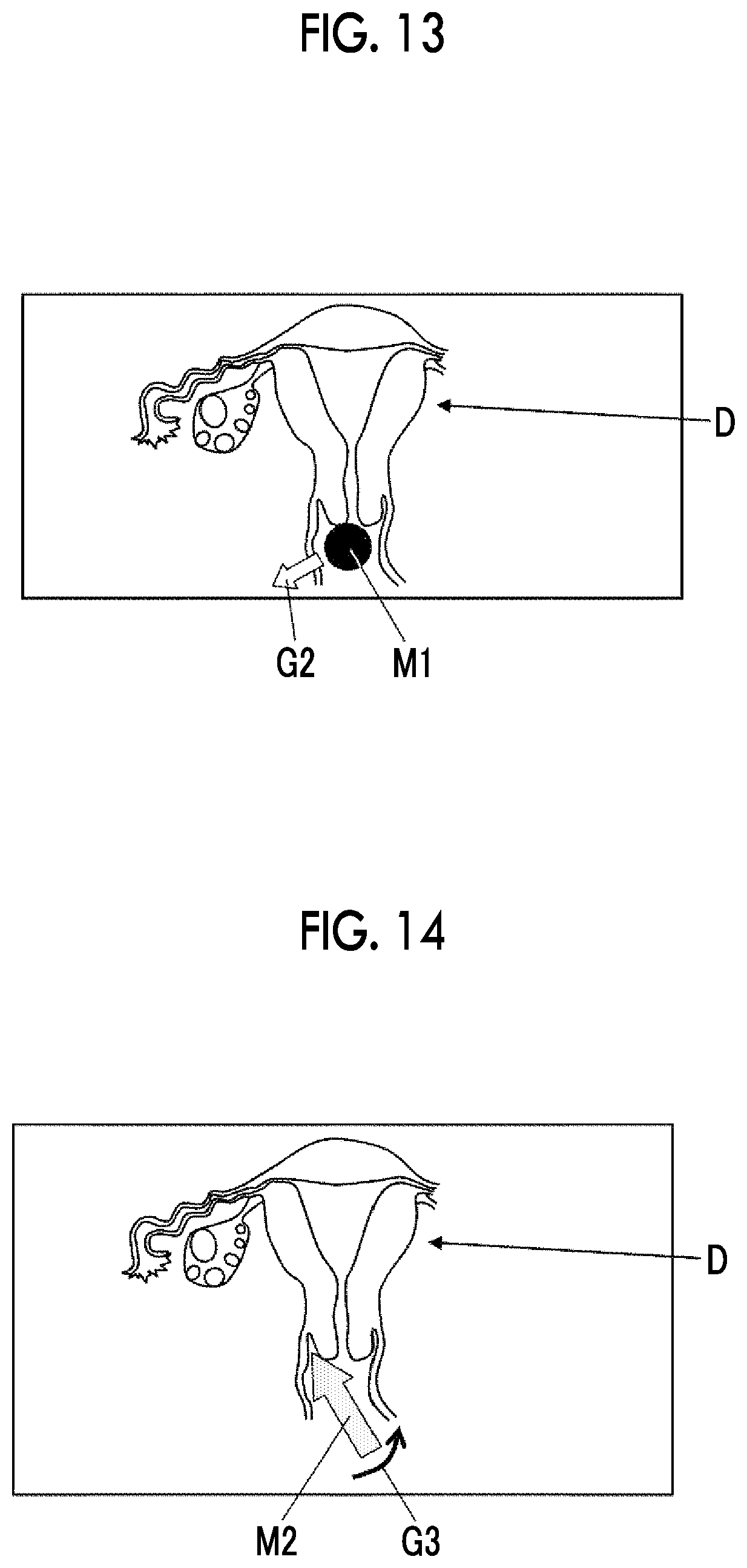 Patent US12303332 Figure 8 – Ultrasound diagnostic system and control method of ultrasound diagnostic system
