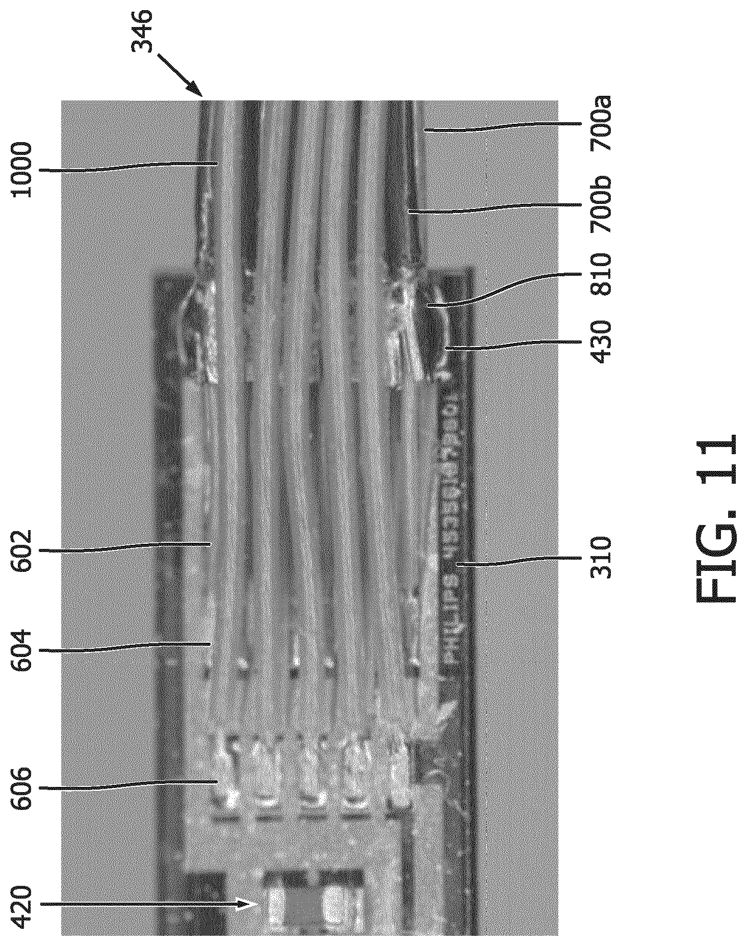 Patent US12303333 Figure 16 – Electrical wire connection in intraluminal ultrasound imaging devices and system