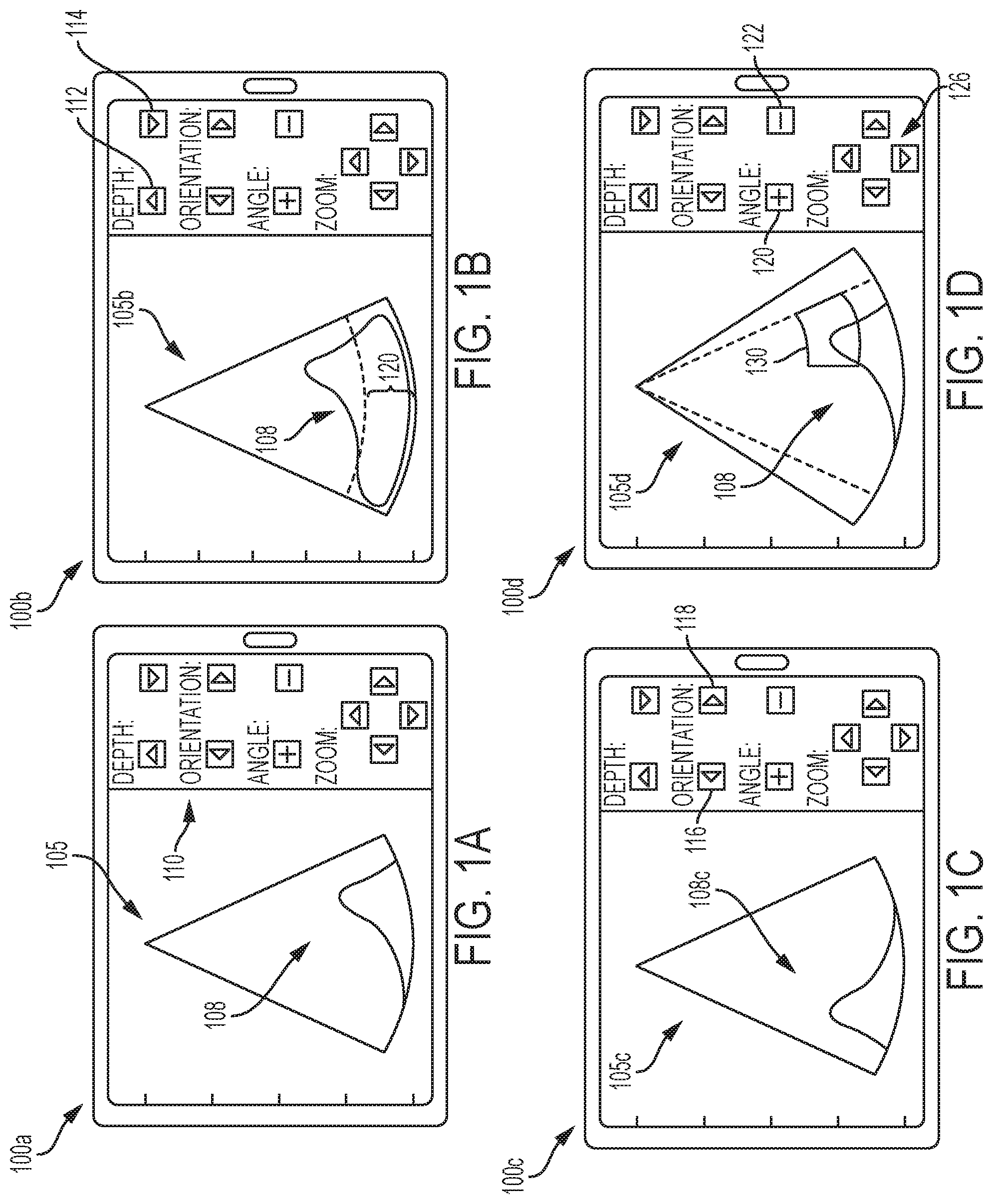 Patent US12303335 Figure 1 – Systems and methods for controlling visualization of ultrasound image data