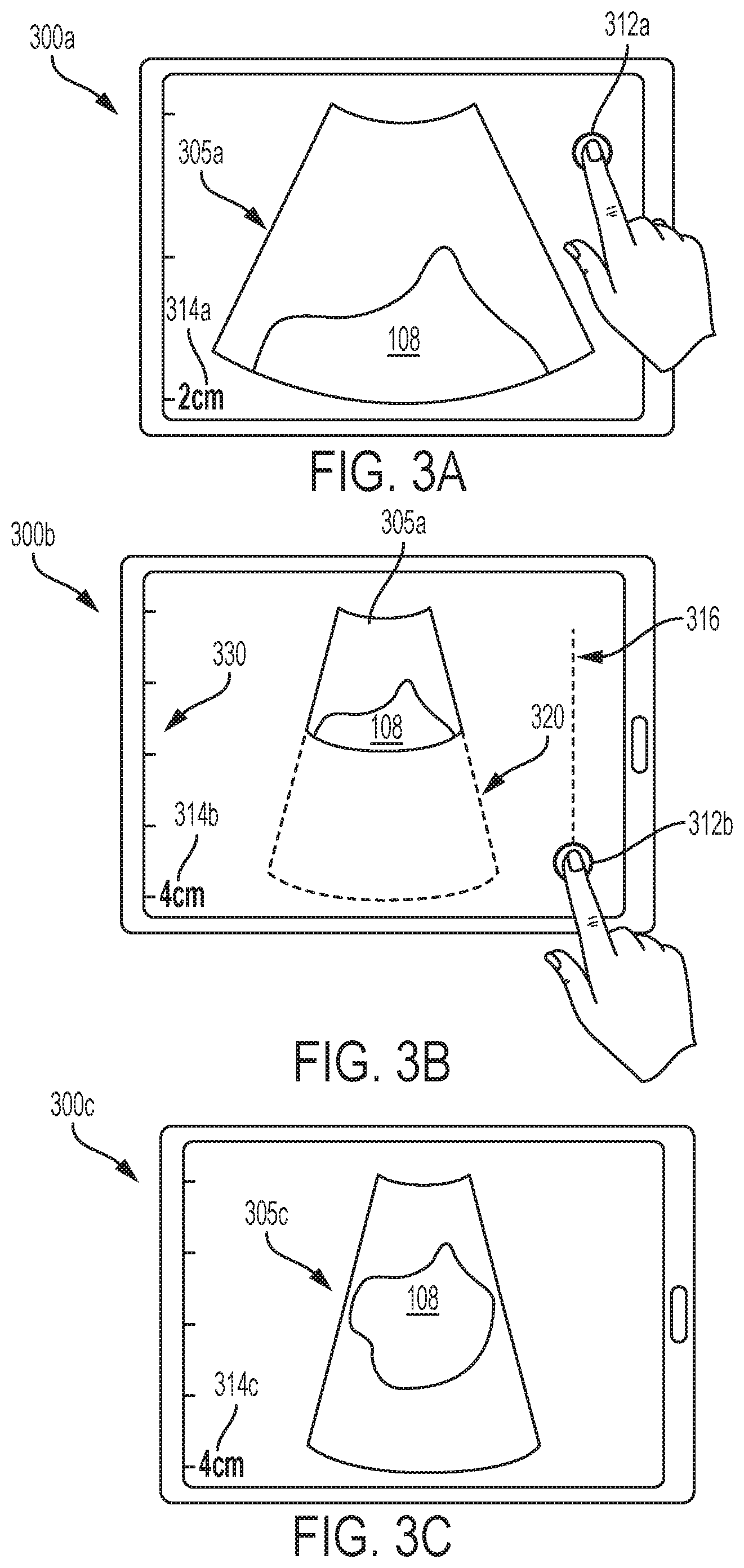 Patent US12303335 Figure 3 – Systems and methods for controlling visualization of ultrasound image data
