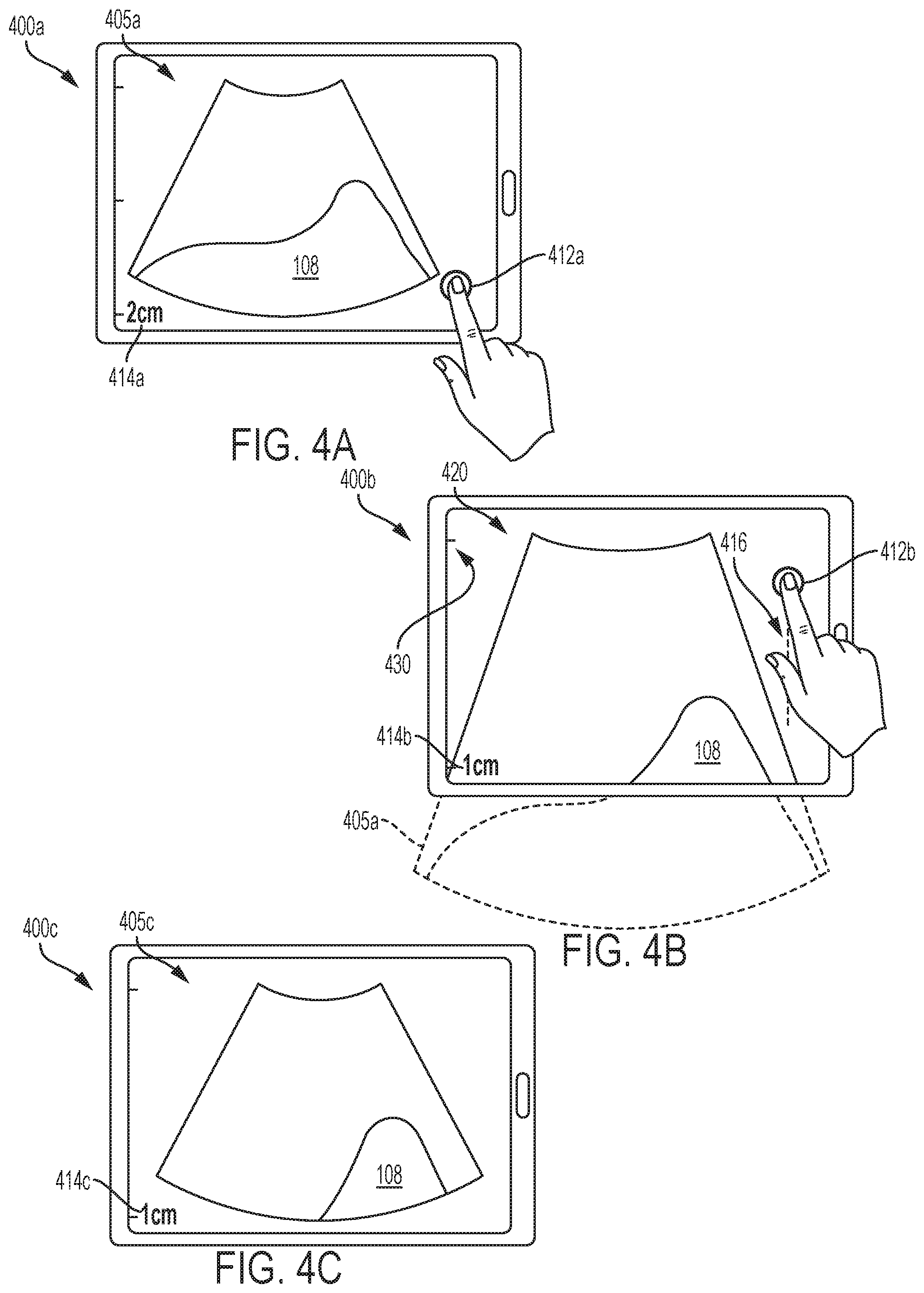 Patent US12303335 Figure 4 – Systems and methods for controlling visualization of ultrasound image data