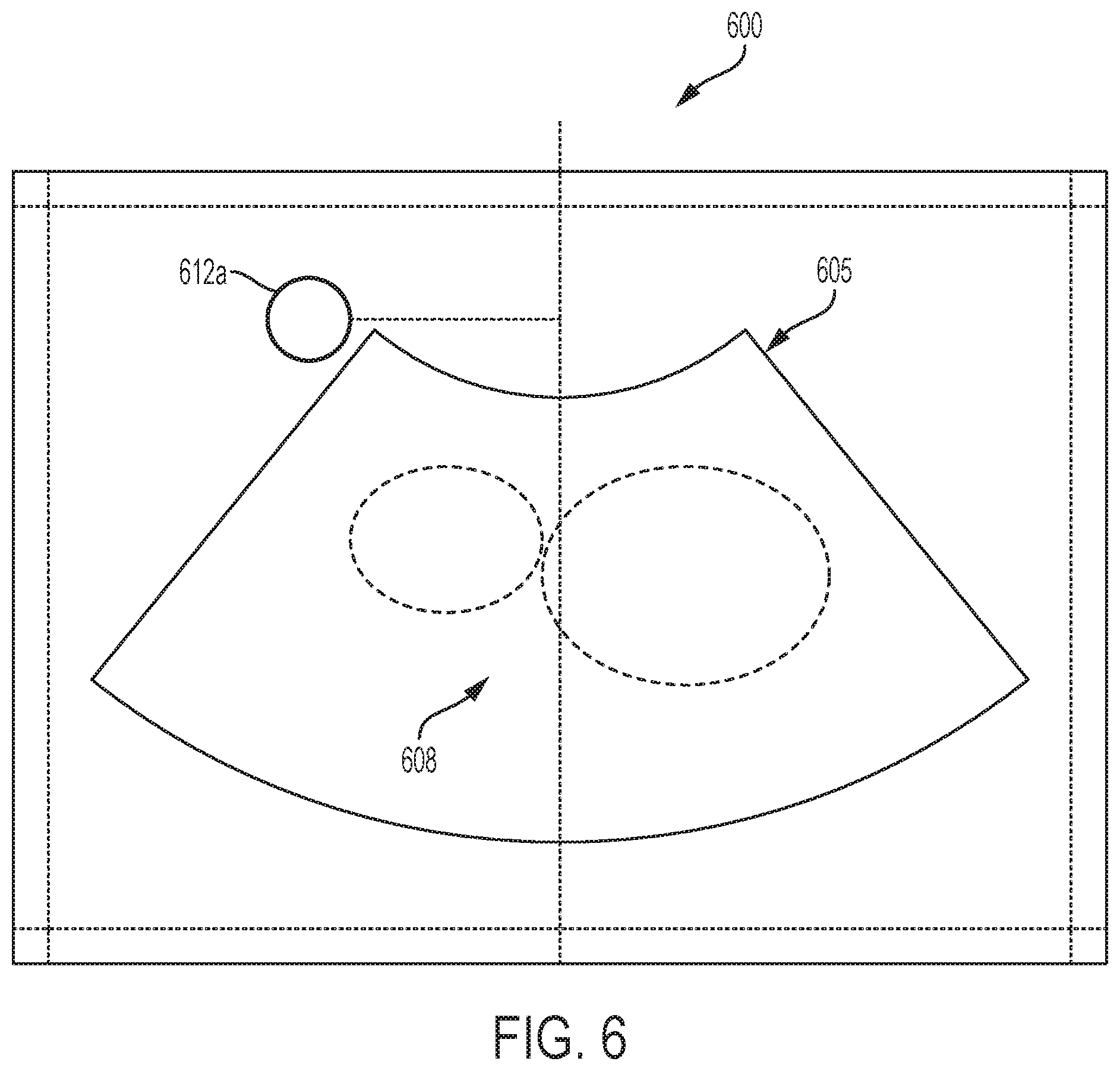 Patent US12303335 Figure 6 – Systems and methods for controlling visualization of ultrasound image data