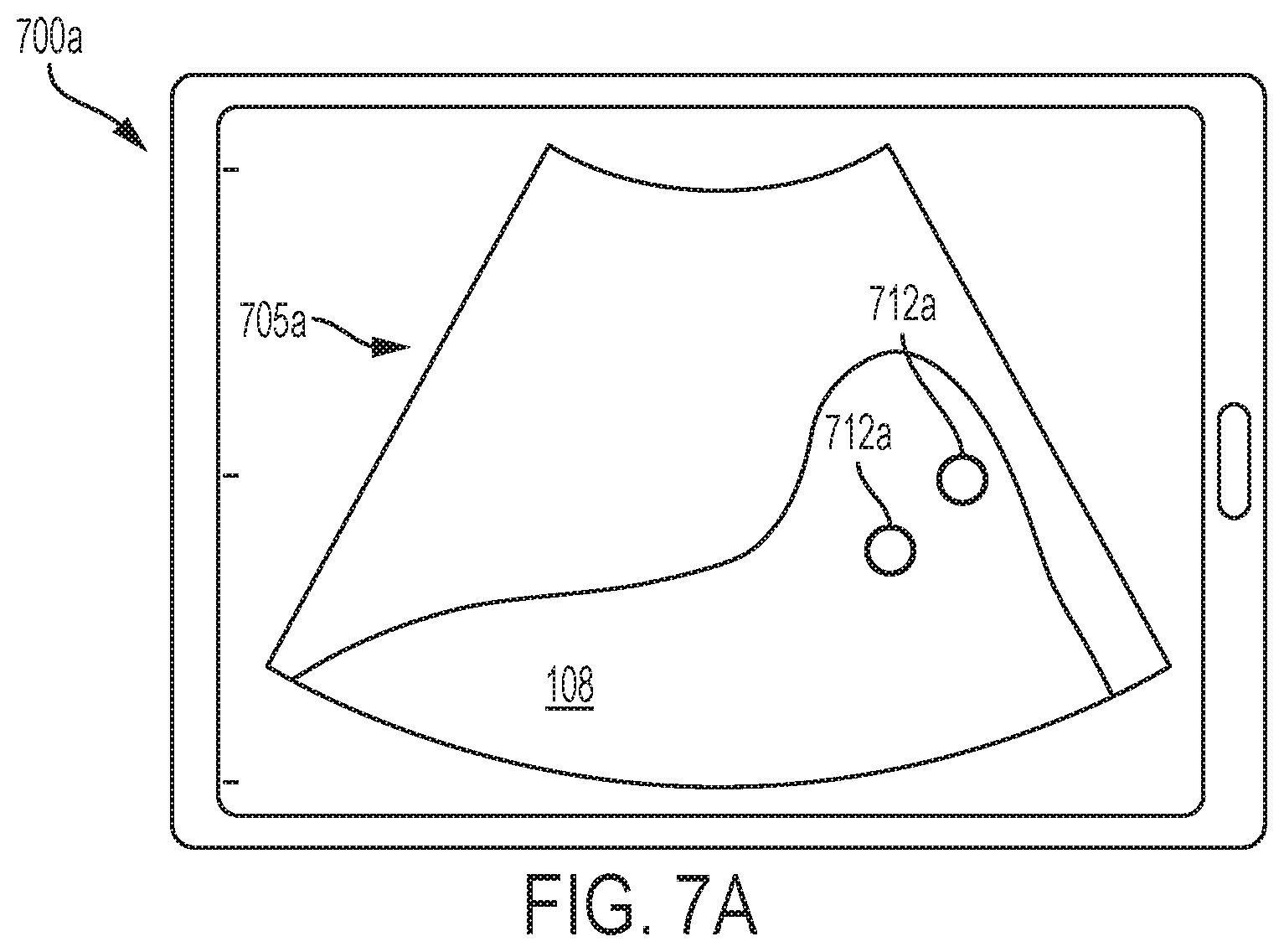 Patent US12303335 Figure 7 – Systems and methods for controlling visualization of ultrasound image data