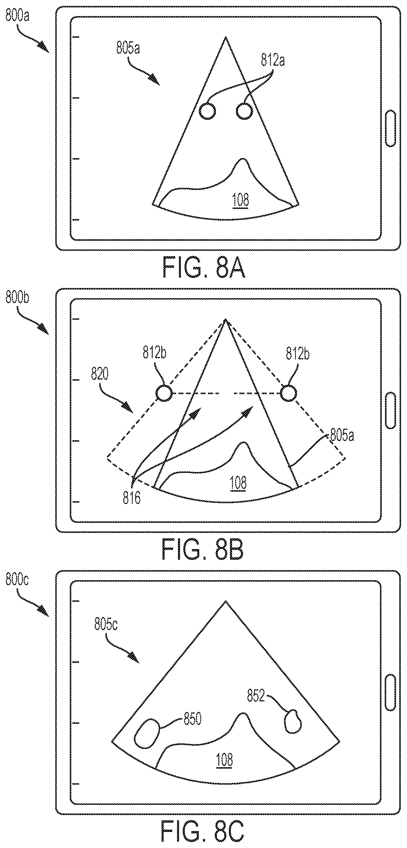 Patent US12303335 Figure 10 – Systems and methods for controlling visualization of ultrasound image data