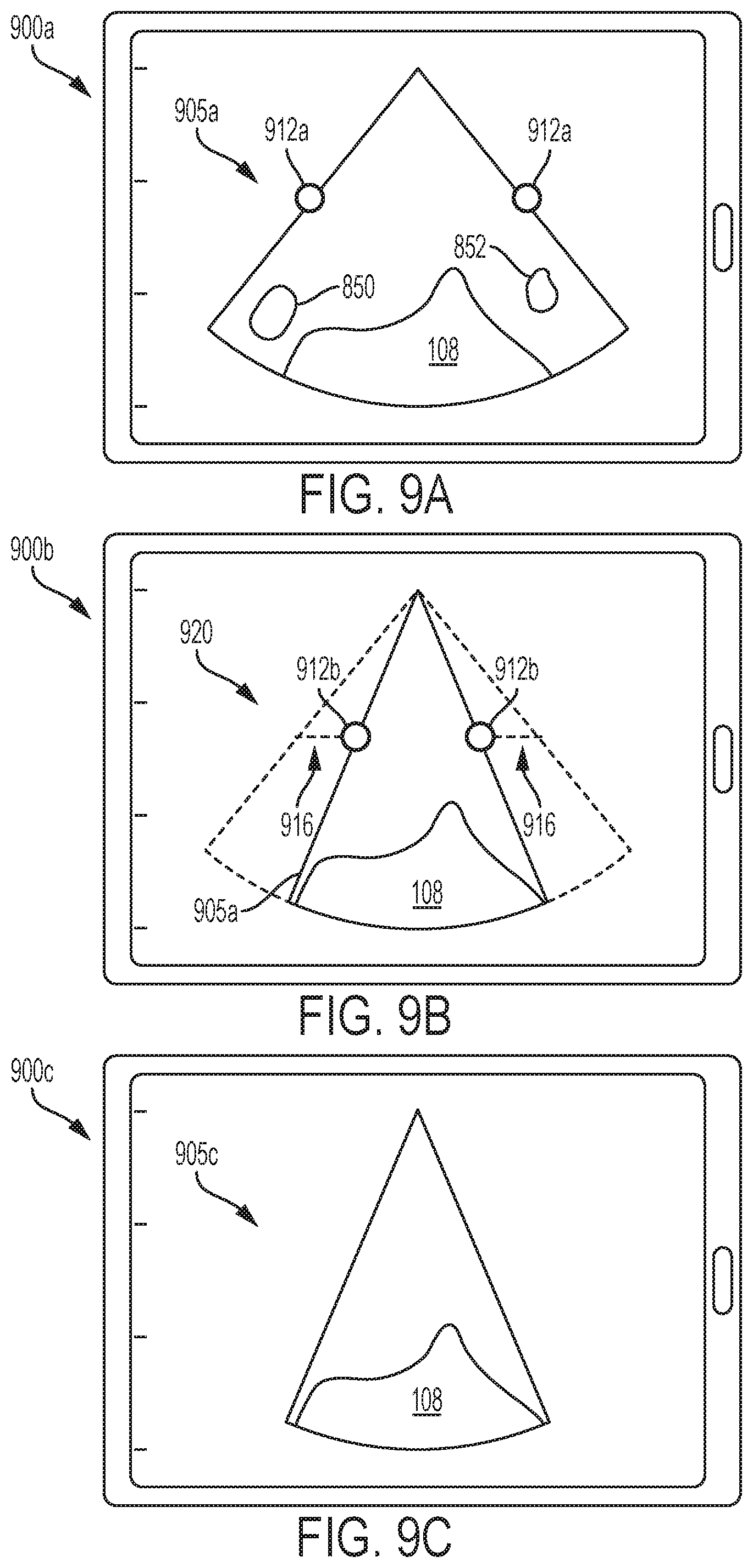 Patent US12303335 Figure 11 – Systems and methods for controlling visualization of ultrasound image data