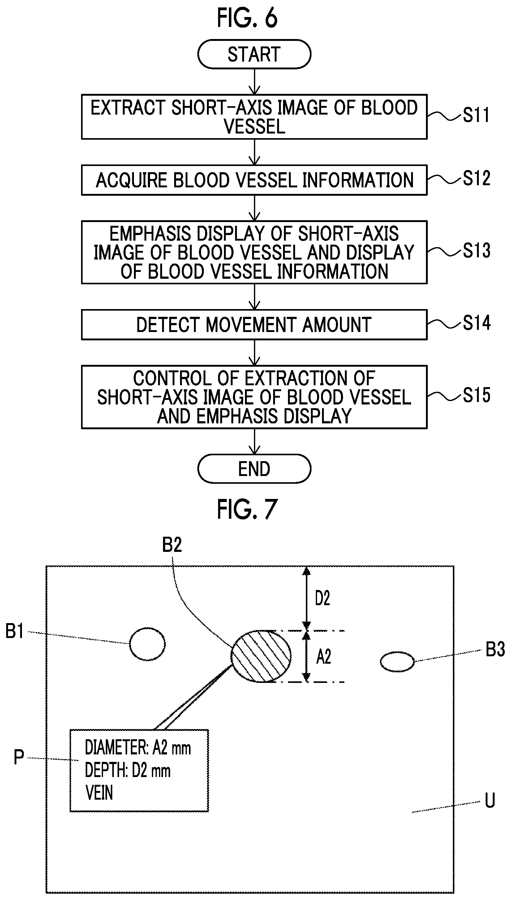Patent US12303336 Figure 4 – Ultrasound diagnostic apparatus and control method of ultrasound diagnostic apparatus