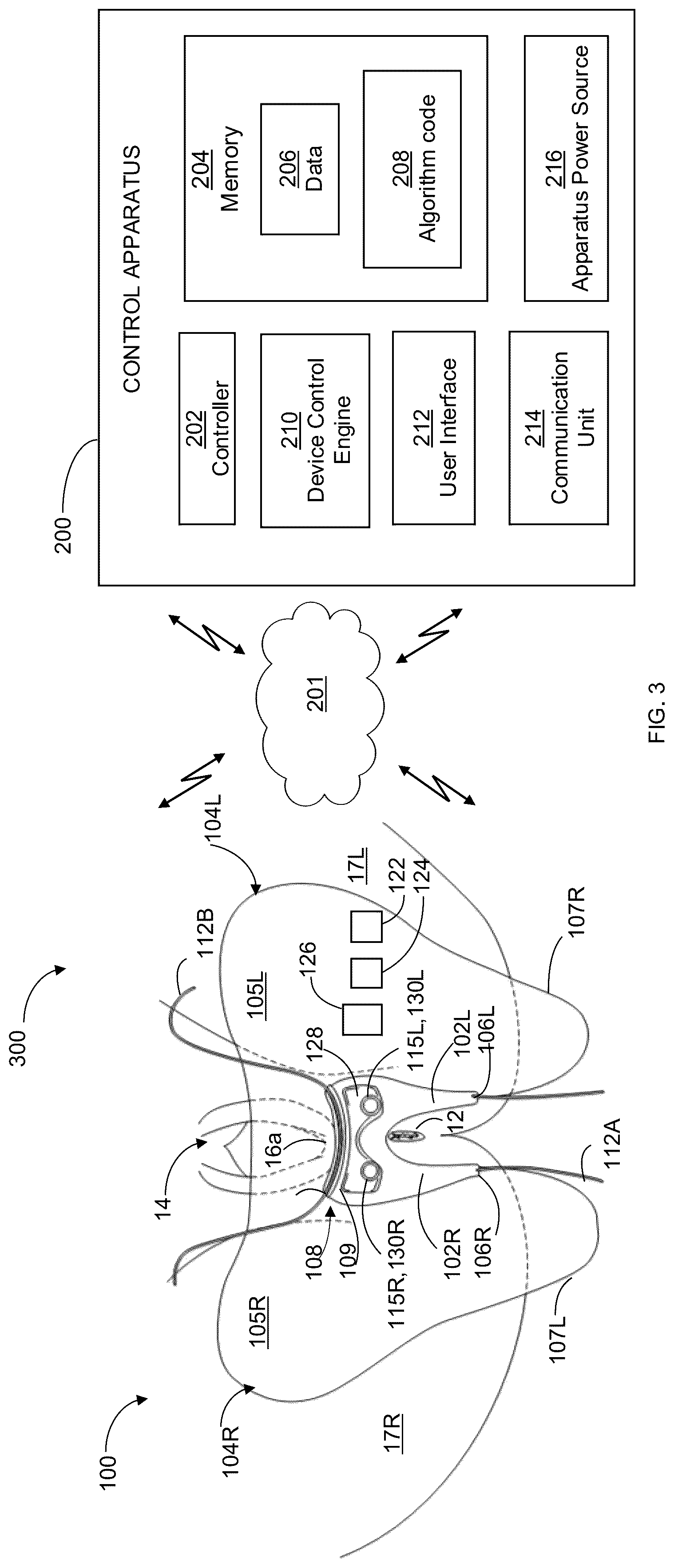 Patent US12303337 Figure 3 – Perineal protection device, system and method