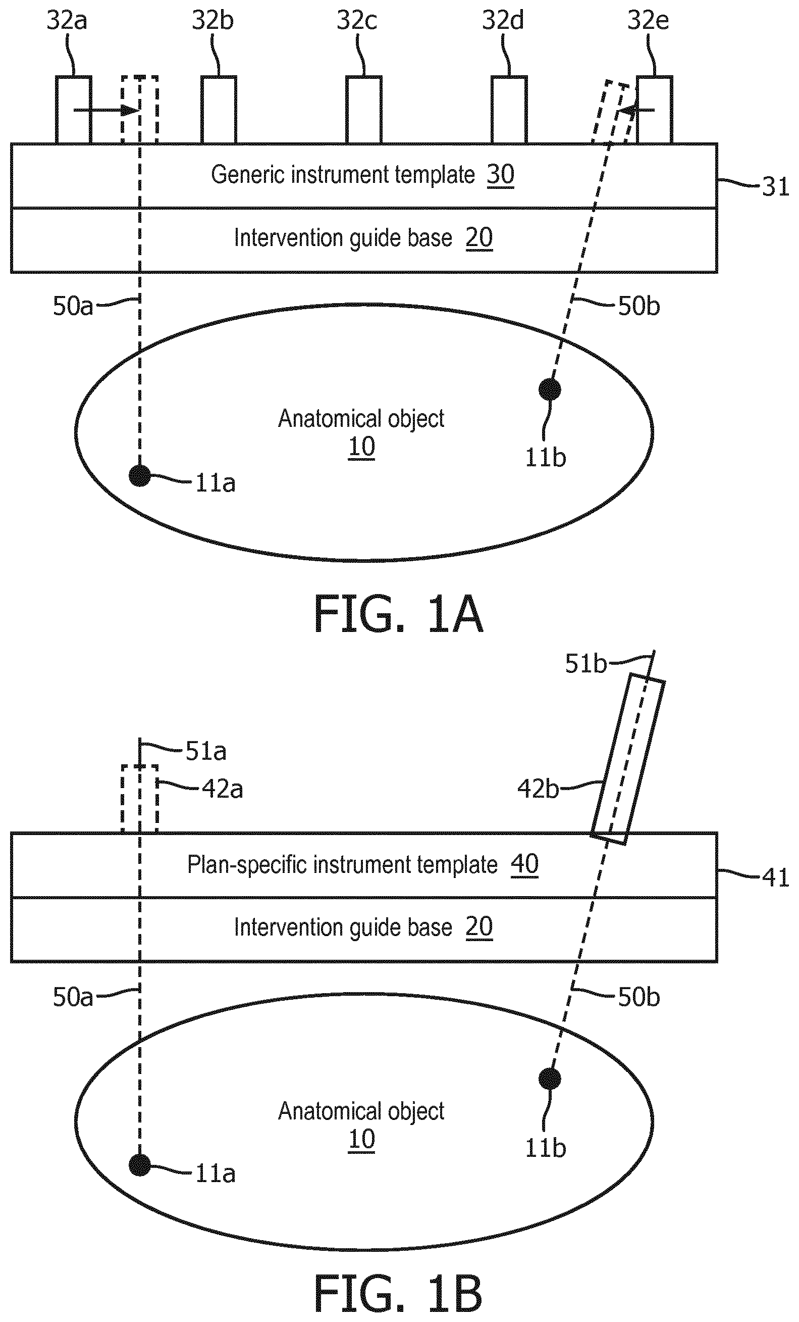 Patent US12303338 — Plan-specific instrument template for percutaneous interventional procedures — Figure 1