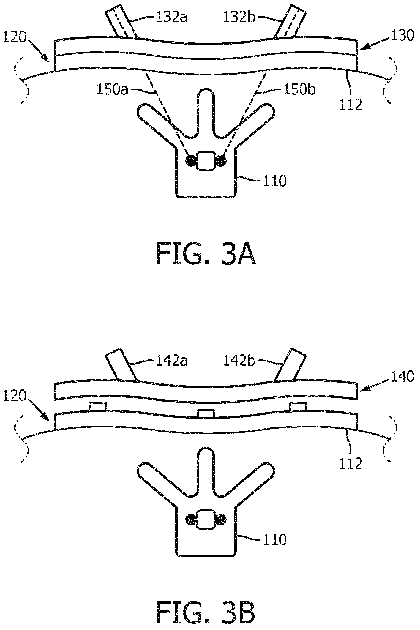 Patent US12303338 Figure 3 – Plan-specific instrument template for percutaneous interventional procedures