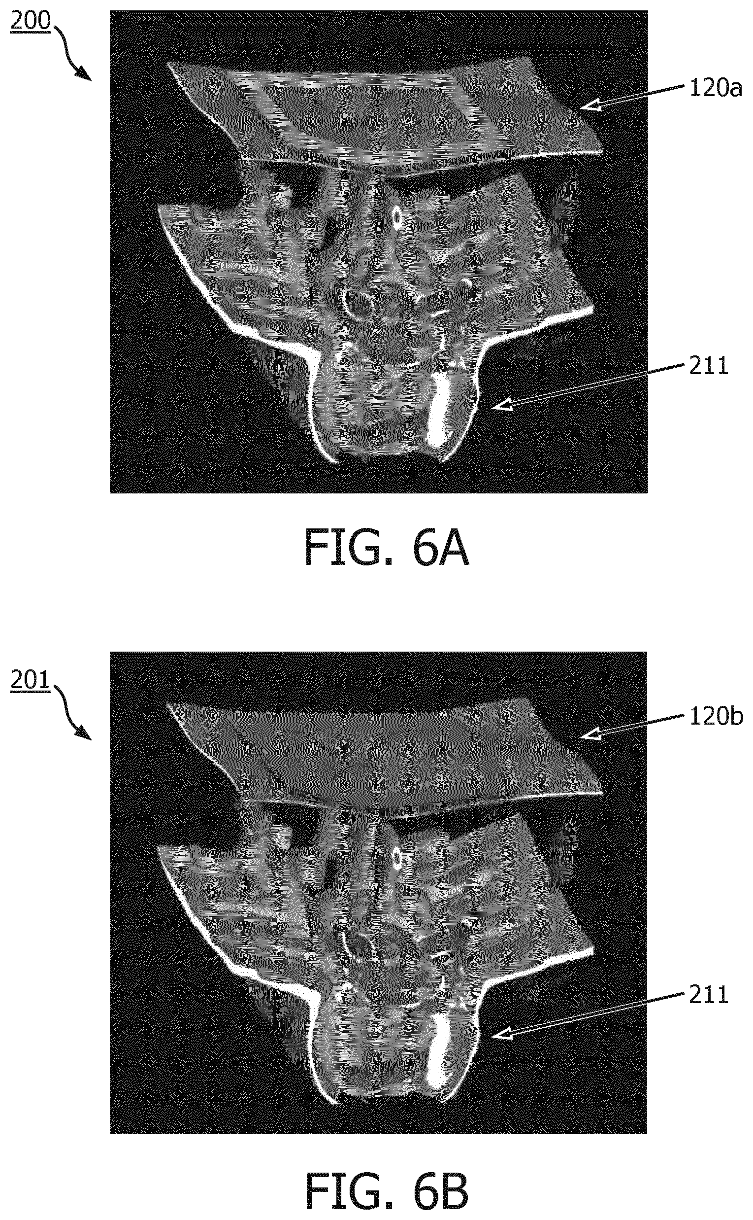 Patent US12303338 Figure 6 – Plan-specific instrument template for percutaneous interventional procedures