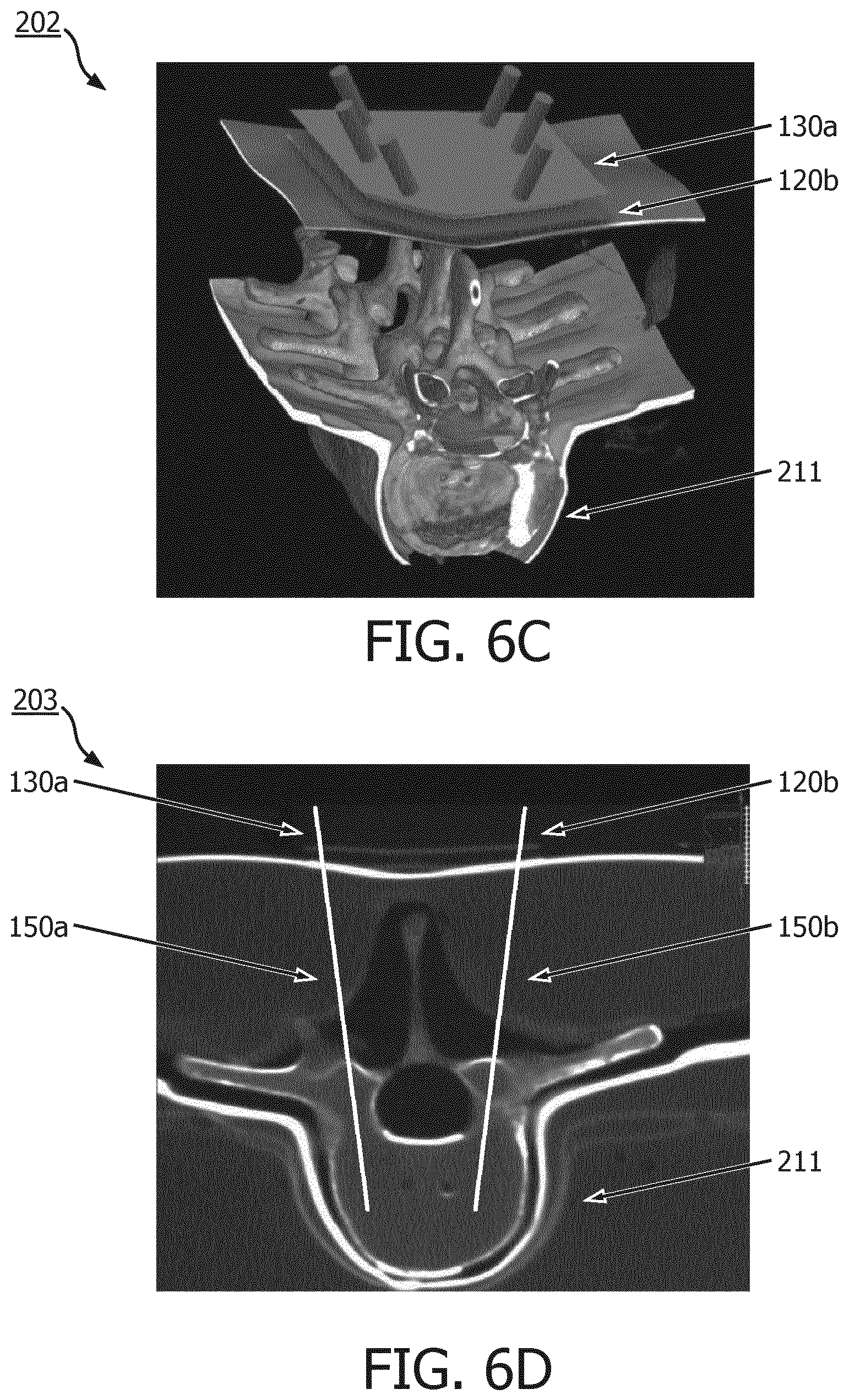 Patent US12303338 Figure 7 – Plan-specific instrument template for percutaneous interventional procedures