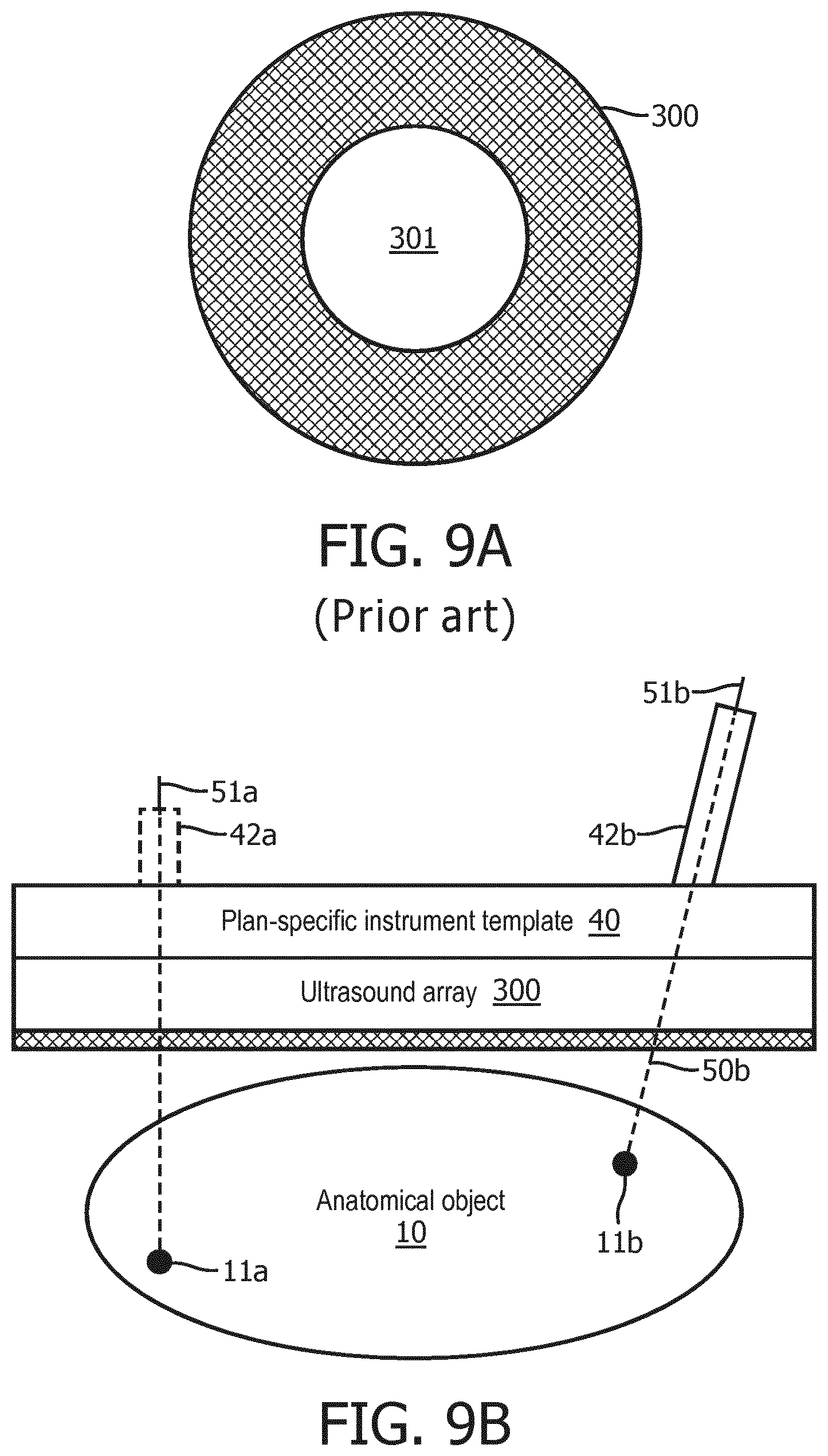 Patent US12303338 Figure 10 – Plan-specific instrument template for percutaneous interventional procedures