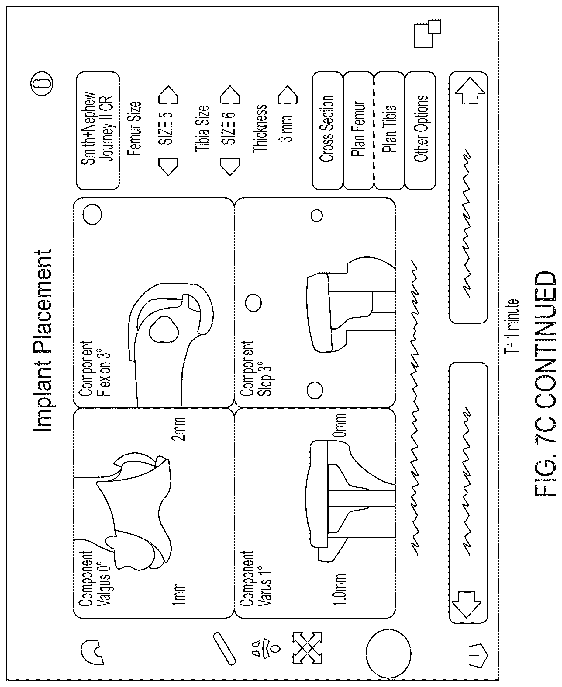 Patent US12303340 Figure 12 – Calibration of 2D images for digital templating using monomarker