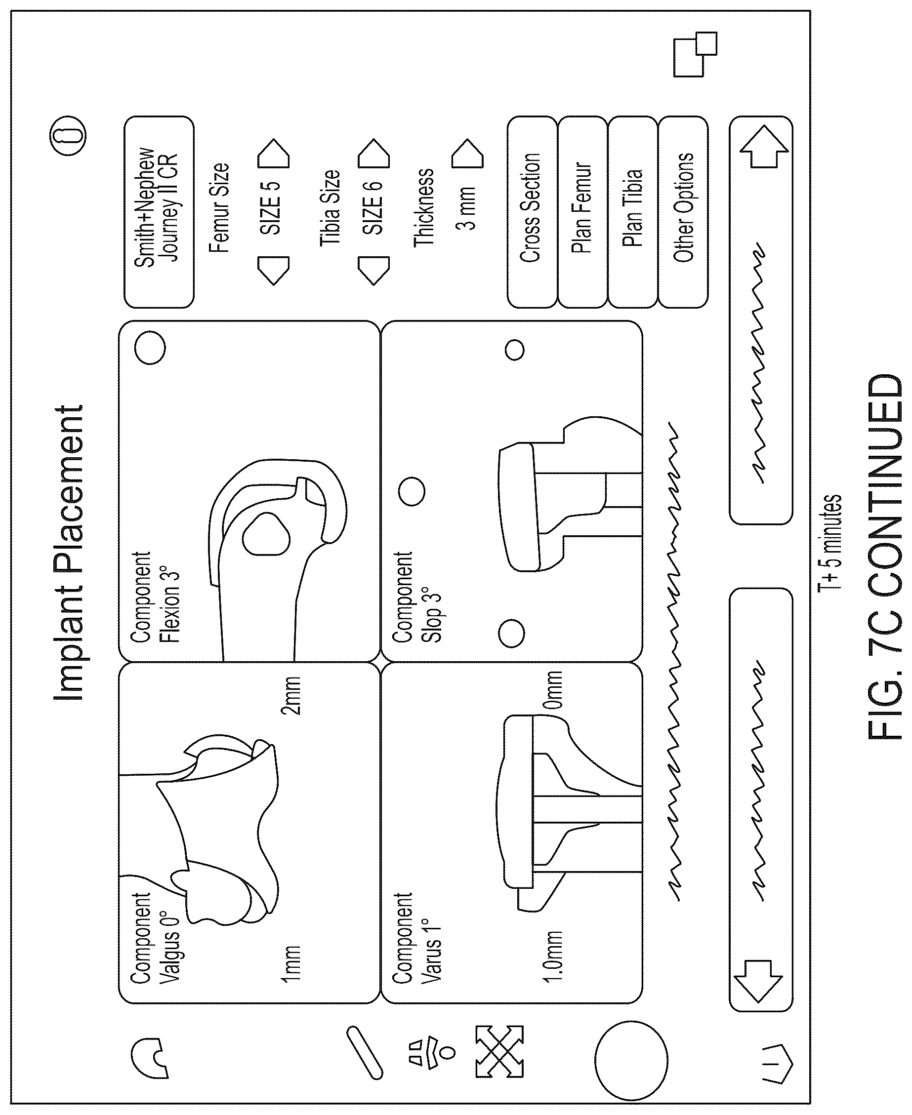 Patent US12303340 Figure 13 – Calibration of 2D images for digital templating using monomarker