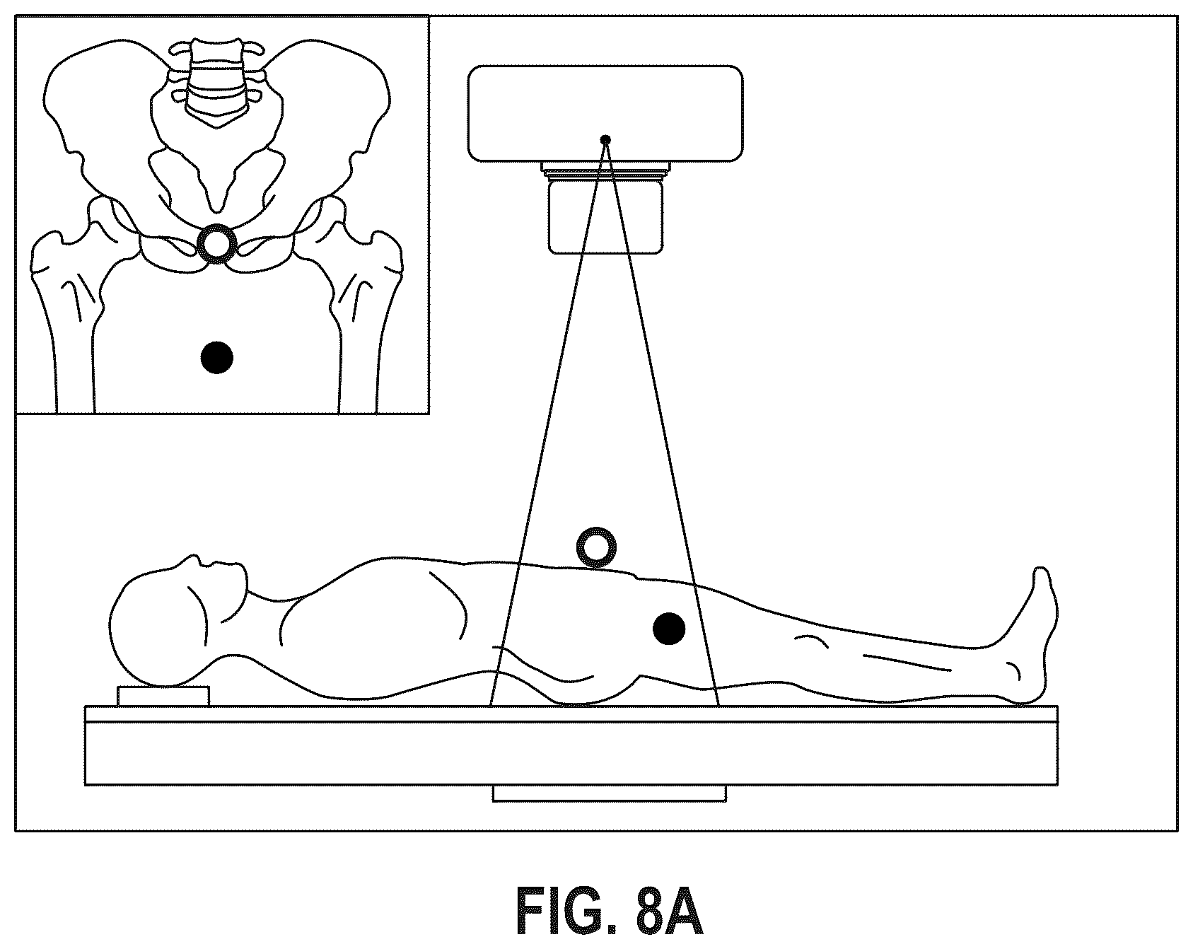 Patent US12303340 Figure 14 – Calibration of 2D images for digital templating using monomarker