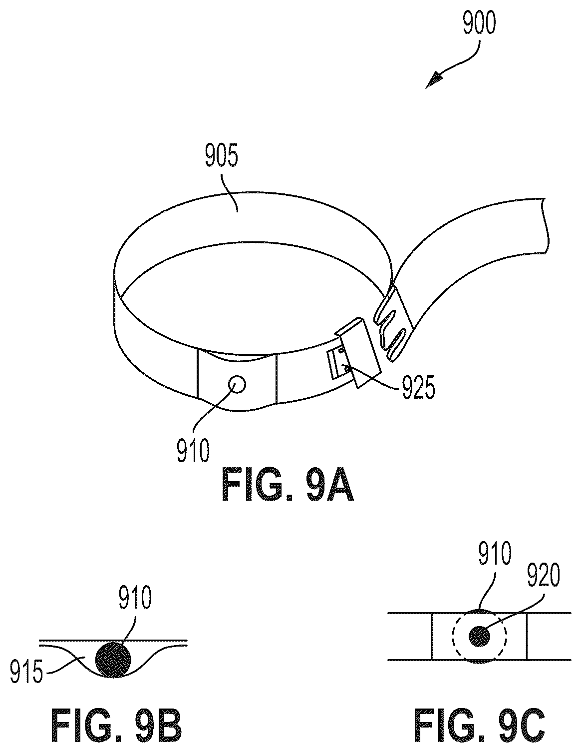 Patent US12303340 Figure 17 – Calibration of 2D images for digital templating using monomarker