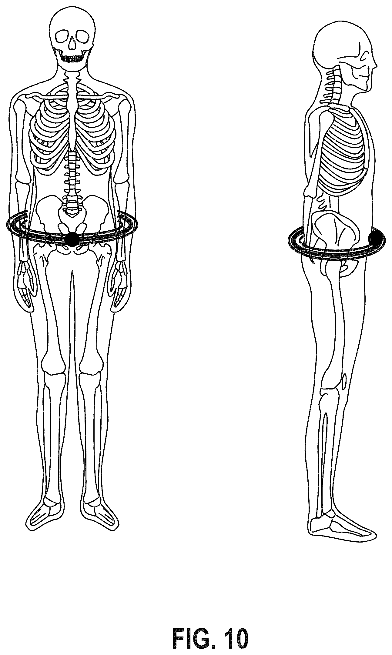 Patent US12303340 Figure 18 – Calibration of 2D images for digital templating using monomarker