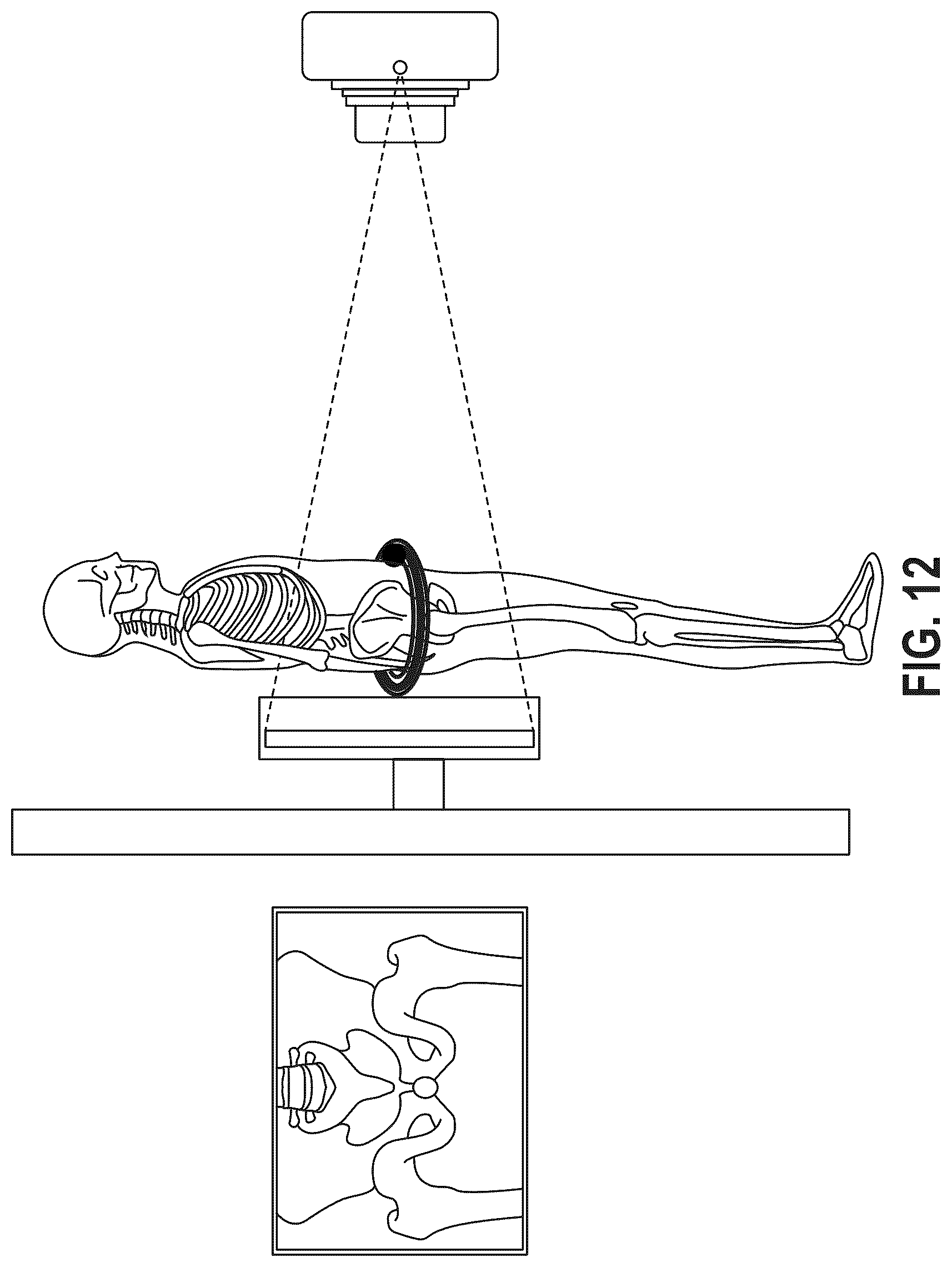 Patent US12303340 Figure 20 – Calibration of 2D images for digital templating using monomarker