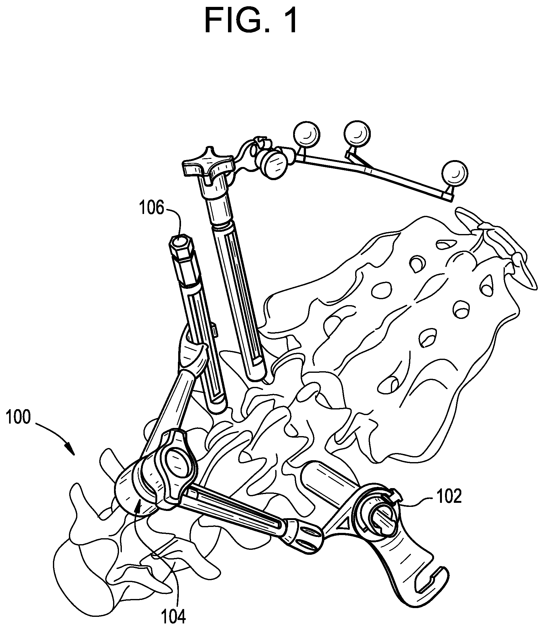 Patent US12303341 Figure 1 – Camera position indication systems and methods