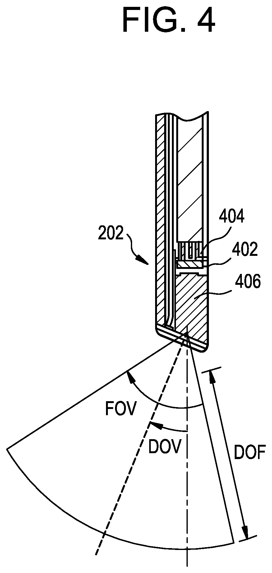 Patent US12303341 Figure 4 – Camera position indication systems and methods