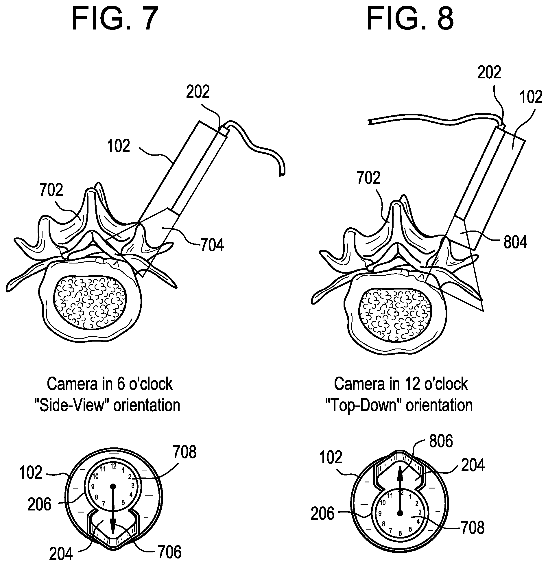 Patent US12303341 Figure 6 – Camera position indication systems and methods