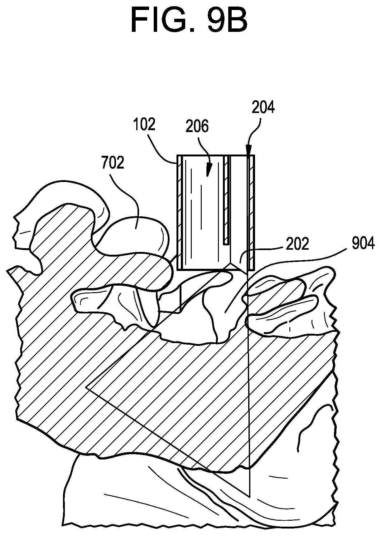Patent US12303341 Figure 8 – Camera position indication systems and methods