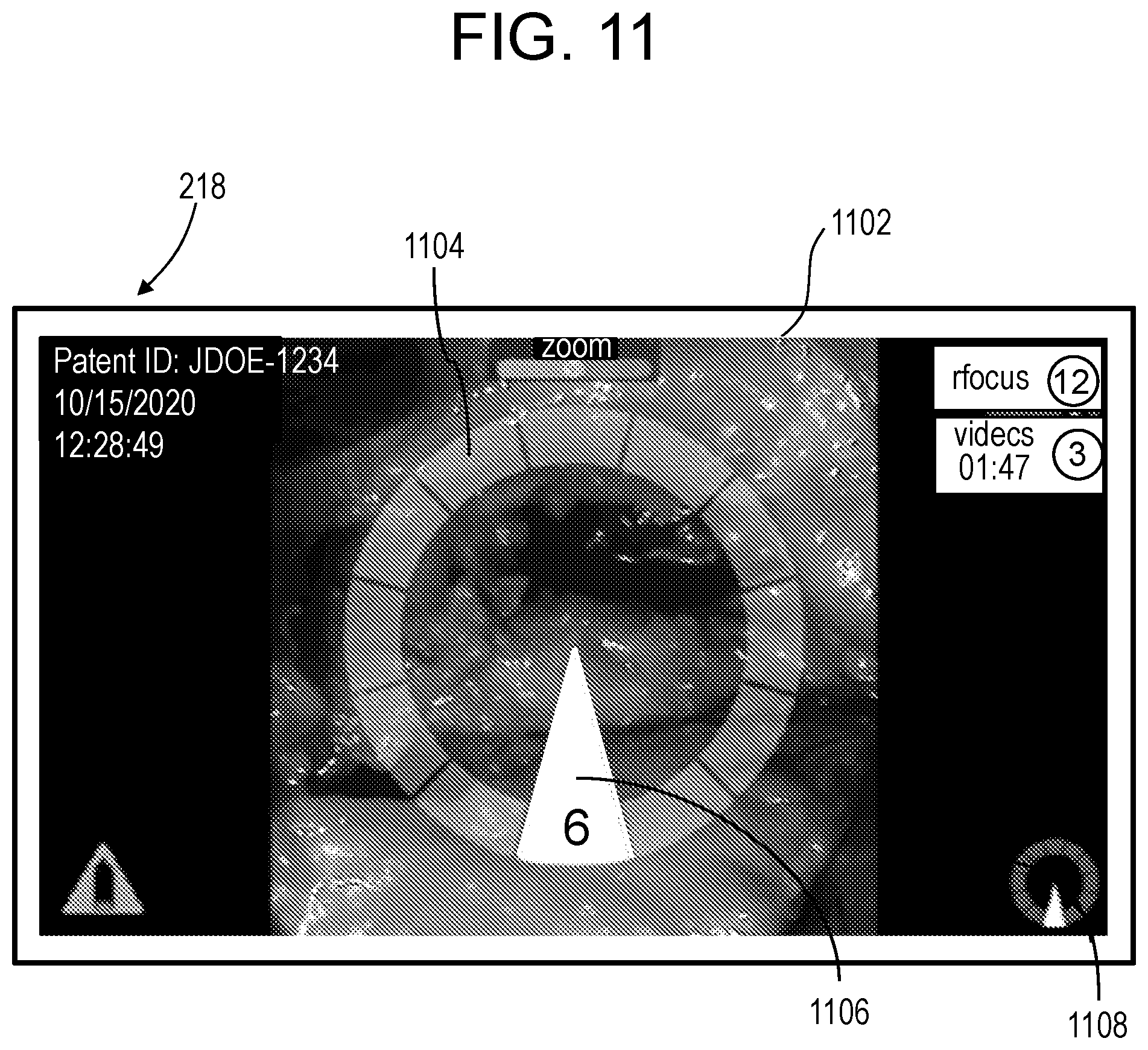 Patent US12303341 Figure 10 – Camera position indication systems and methods