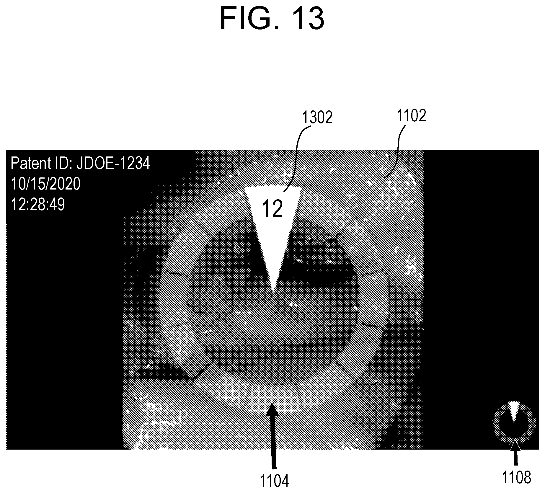 Patent US12303341 Figure 12 – Camera position indication systems and methods