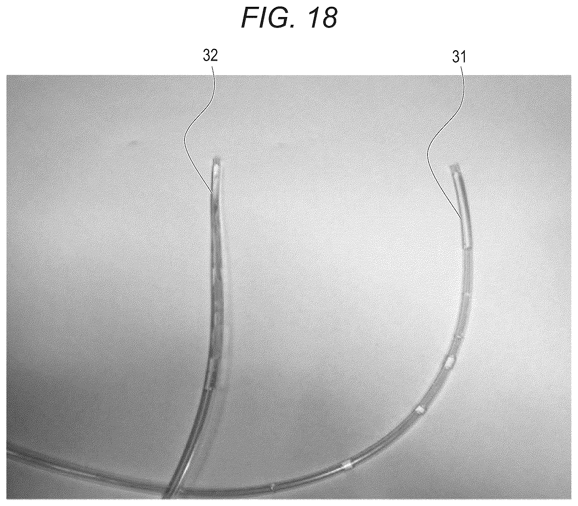 Patent US12303342 Figure 17 – Liquid processing nozzle for purifying liquid piping of dental device