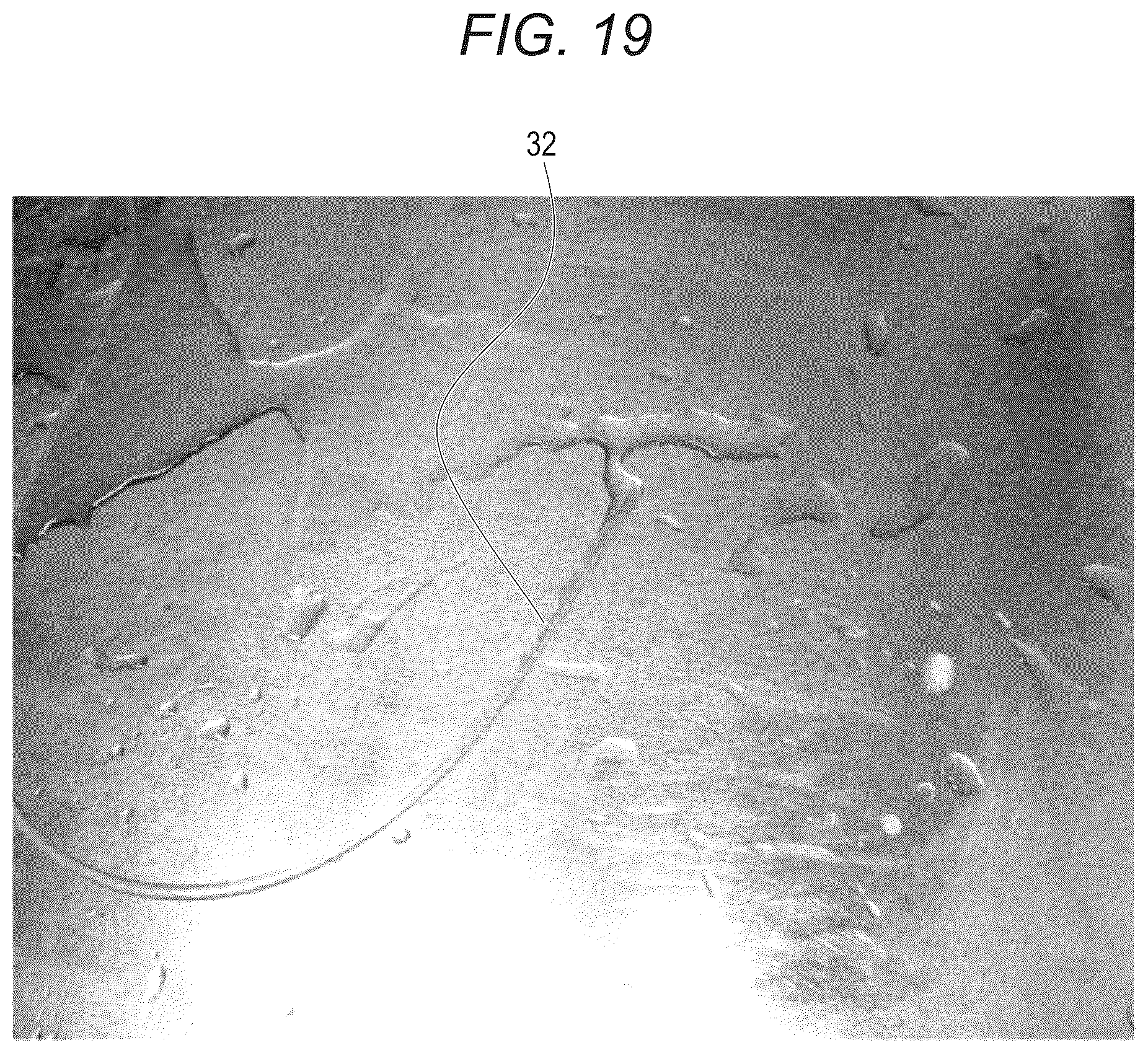 Patent US12303342 Figure 18 – Liquid processing nozzle for purifying liquid piping of dental device