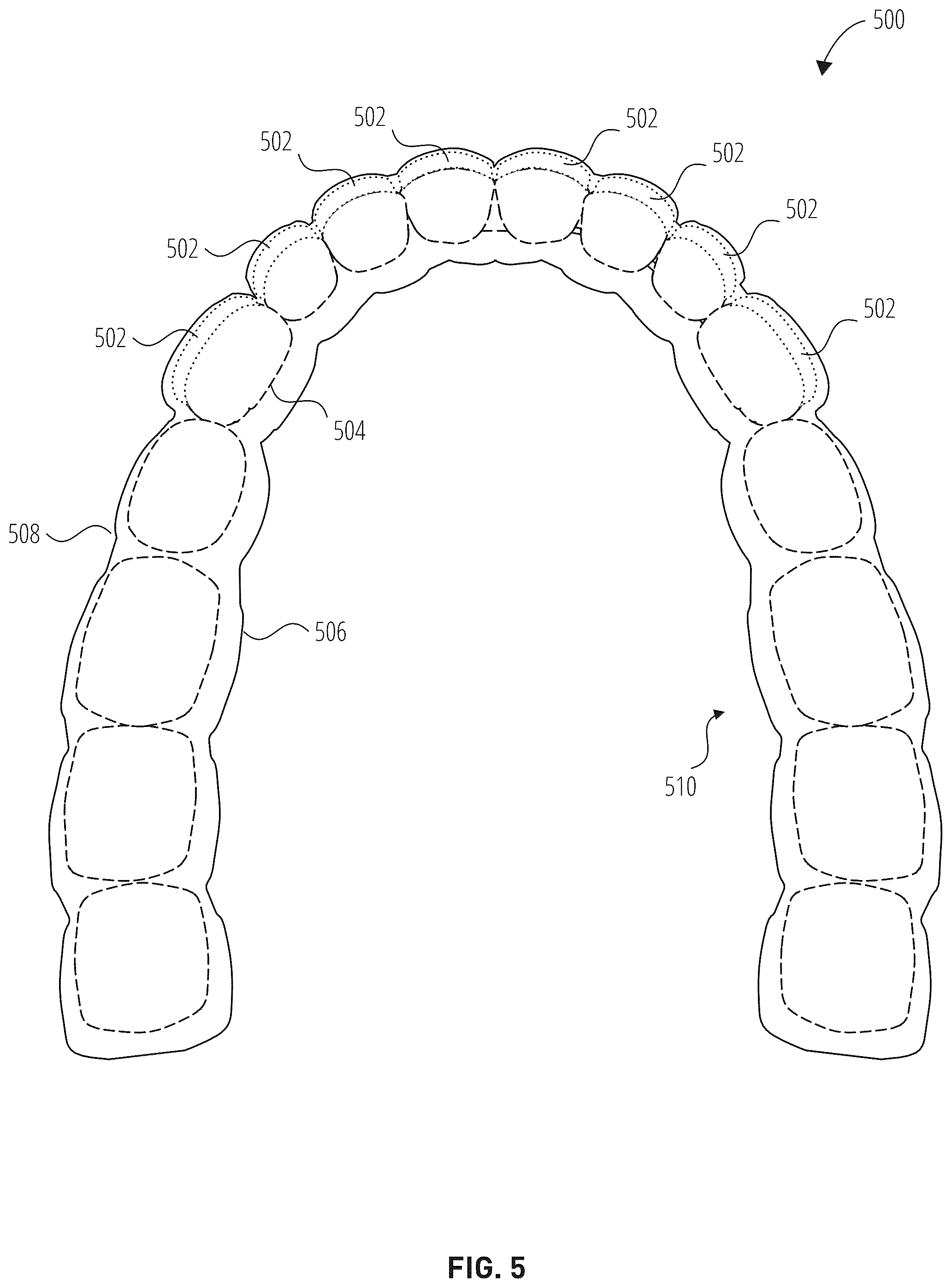 Patent US12303345 Figure 5 – Dental treatment tray