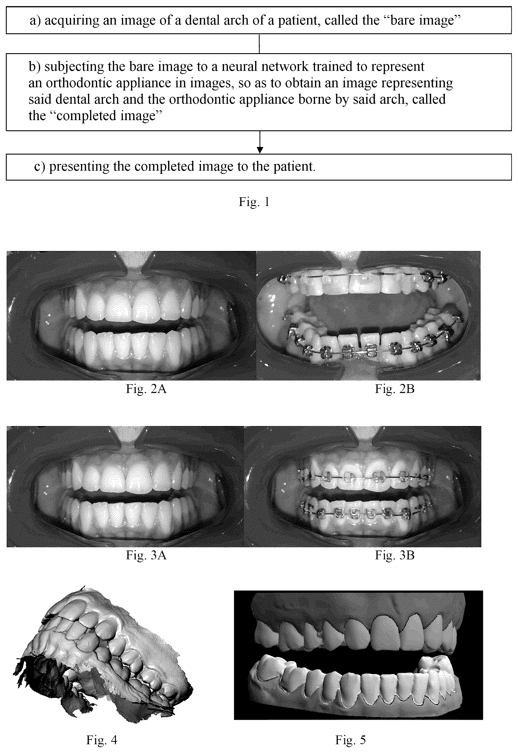 Patent US12303346 Figure 1 – Method for simulating a dental situation