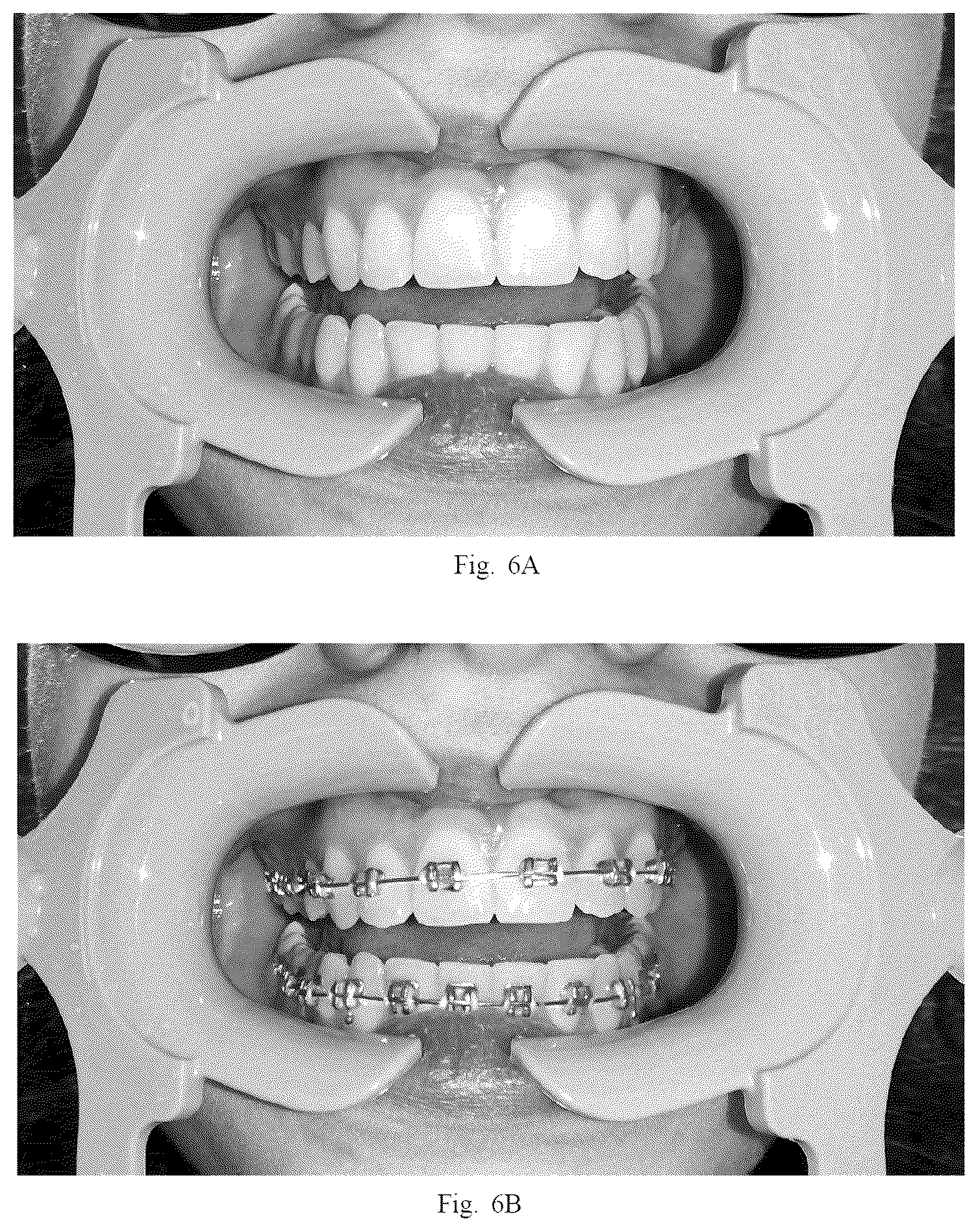 Patent US12303346 Figure 2 – Method for simulating a dental situation