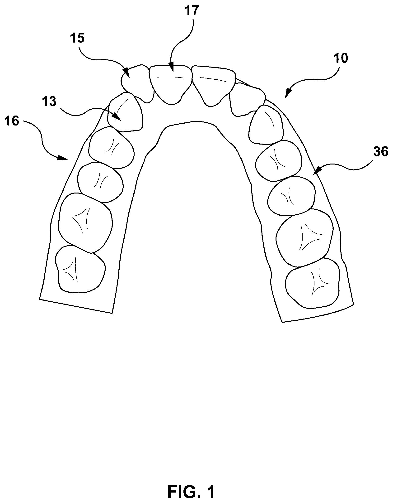 Patent US12303347 Figure 1 – Methods and systems for determining an orthodontic treatment
