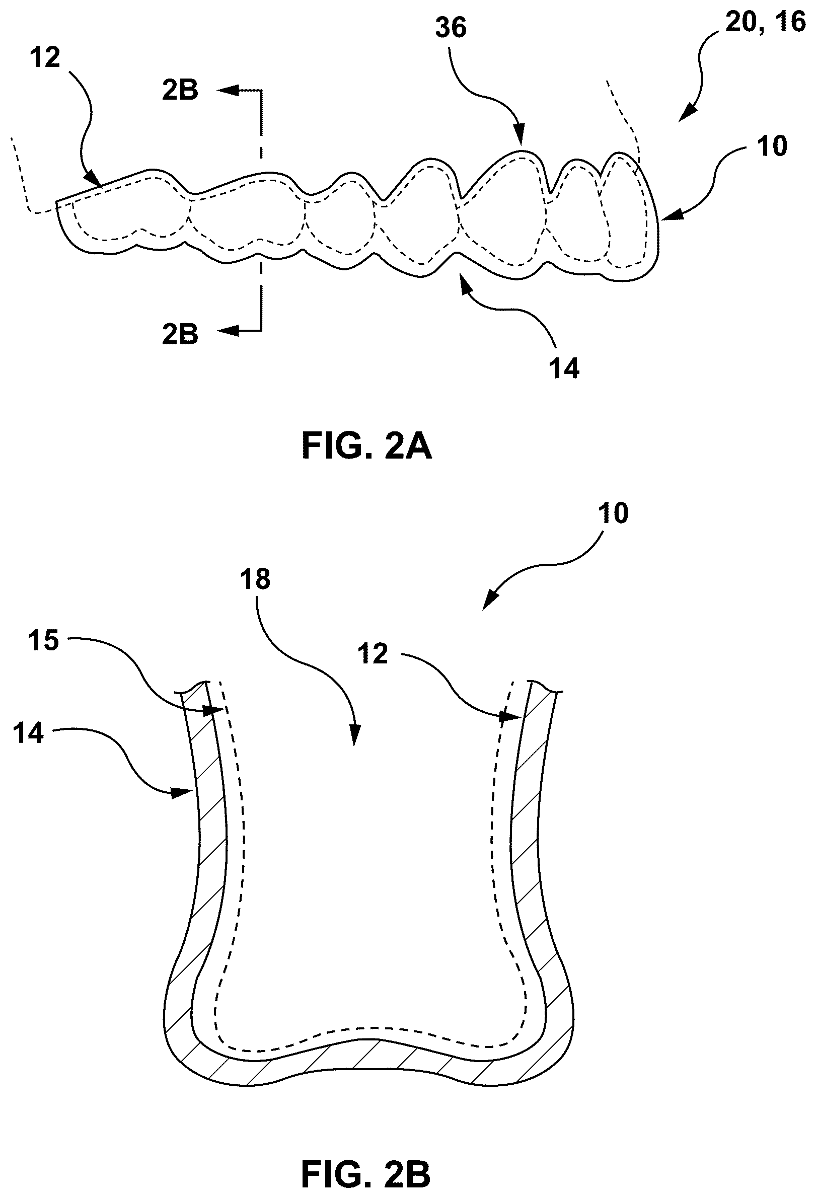 Patent US12303347 Figure 2 – Methods and systems for determining an orthodontic treatment