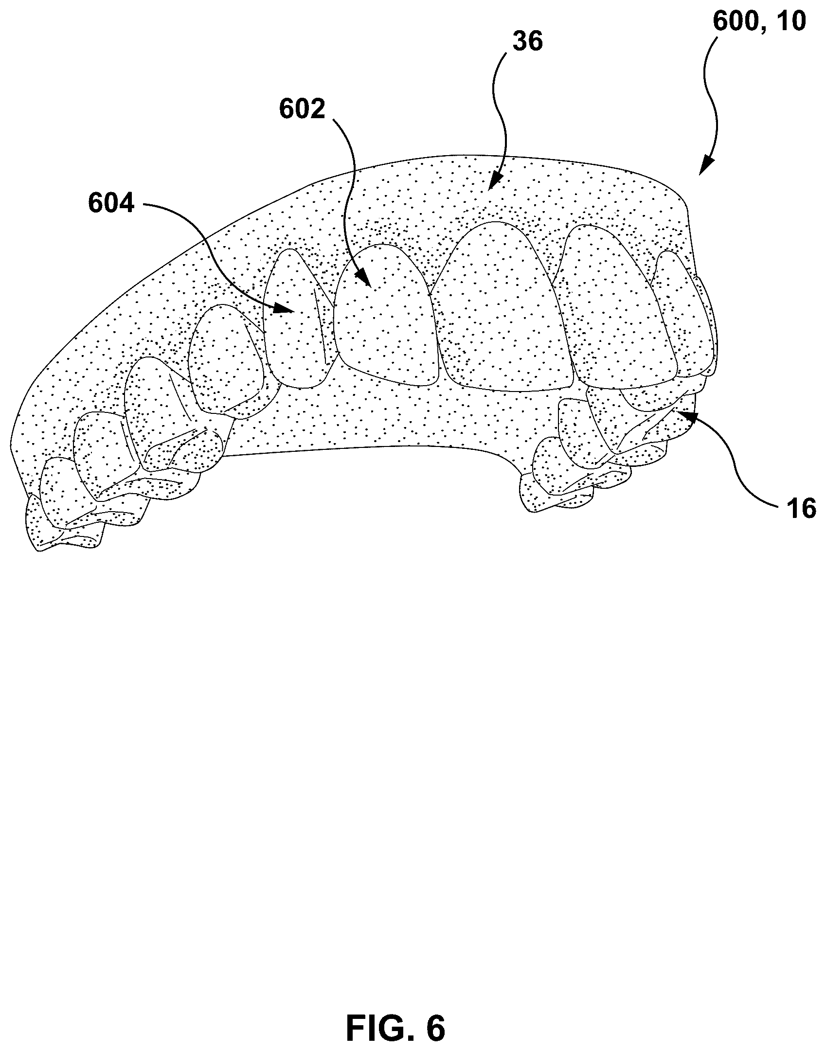 Patent US12303347 Figure 5 – Methods and systems for determining an orthodontic treatment