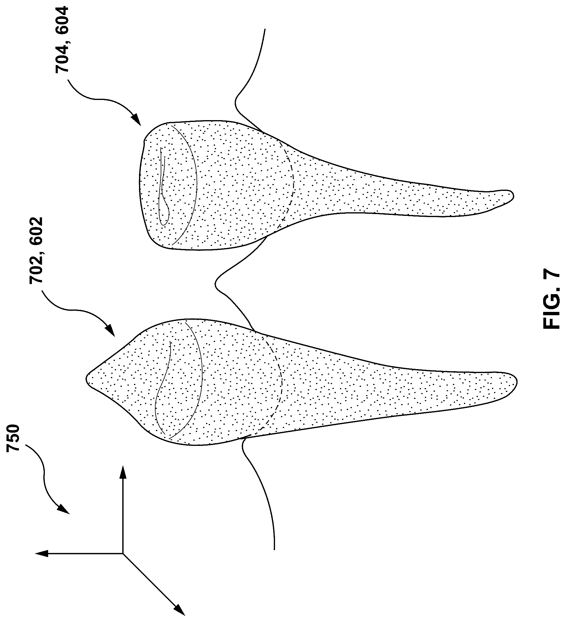 Patent US12303347 Figure 6 – Methods and systems for determining an orthodontic treatment